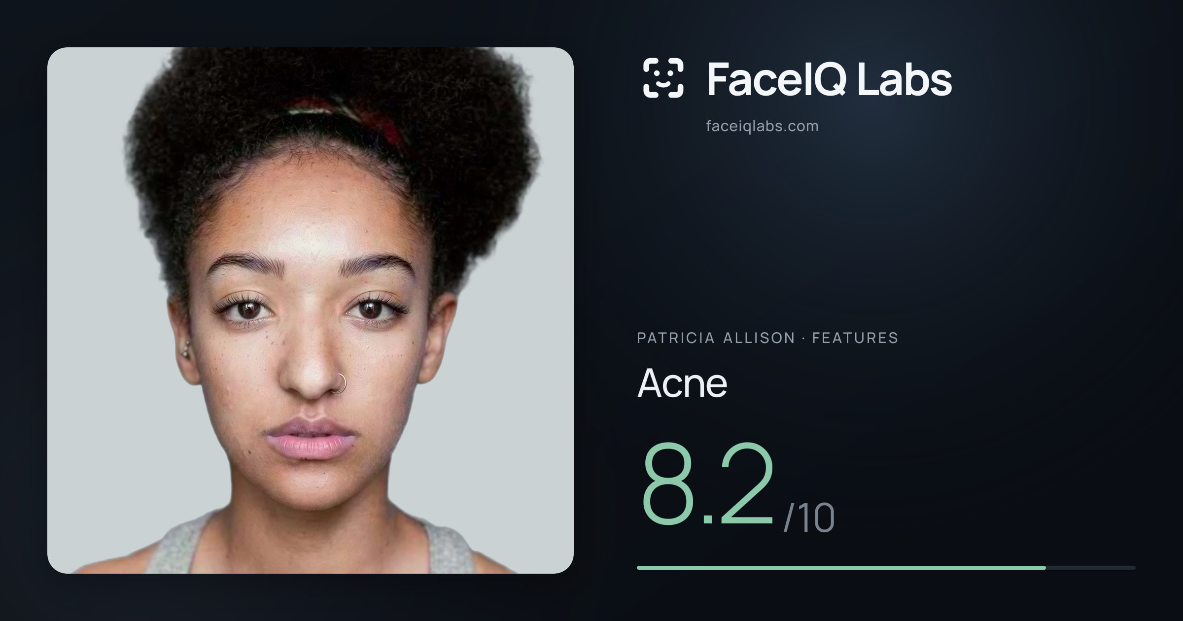Patricia Allison Acne: 8.2/10, drawn on the photo