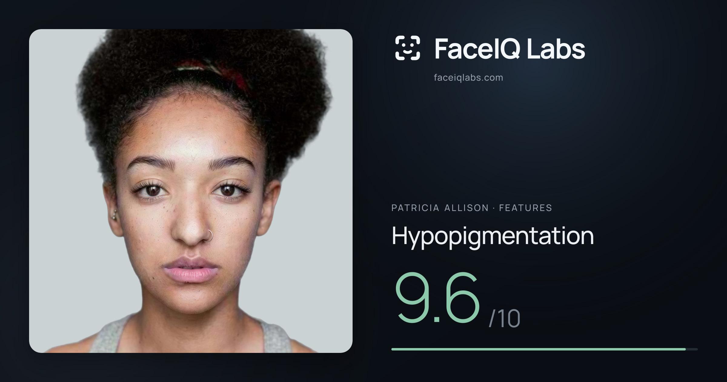 Patricia Allison Hypopigmentation: 9.6/10, drawn on the photo