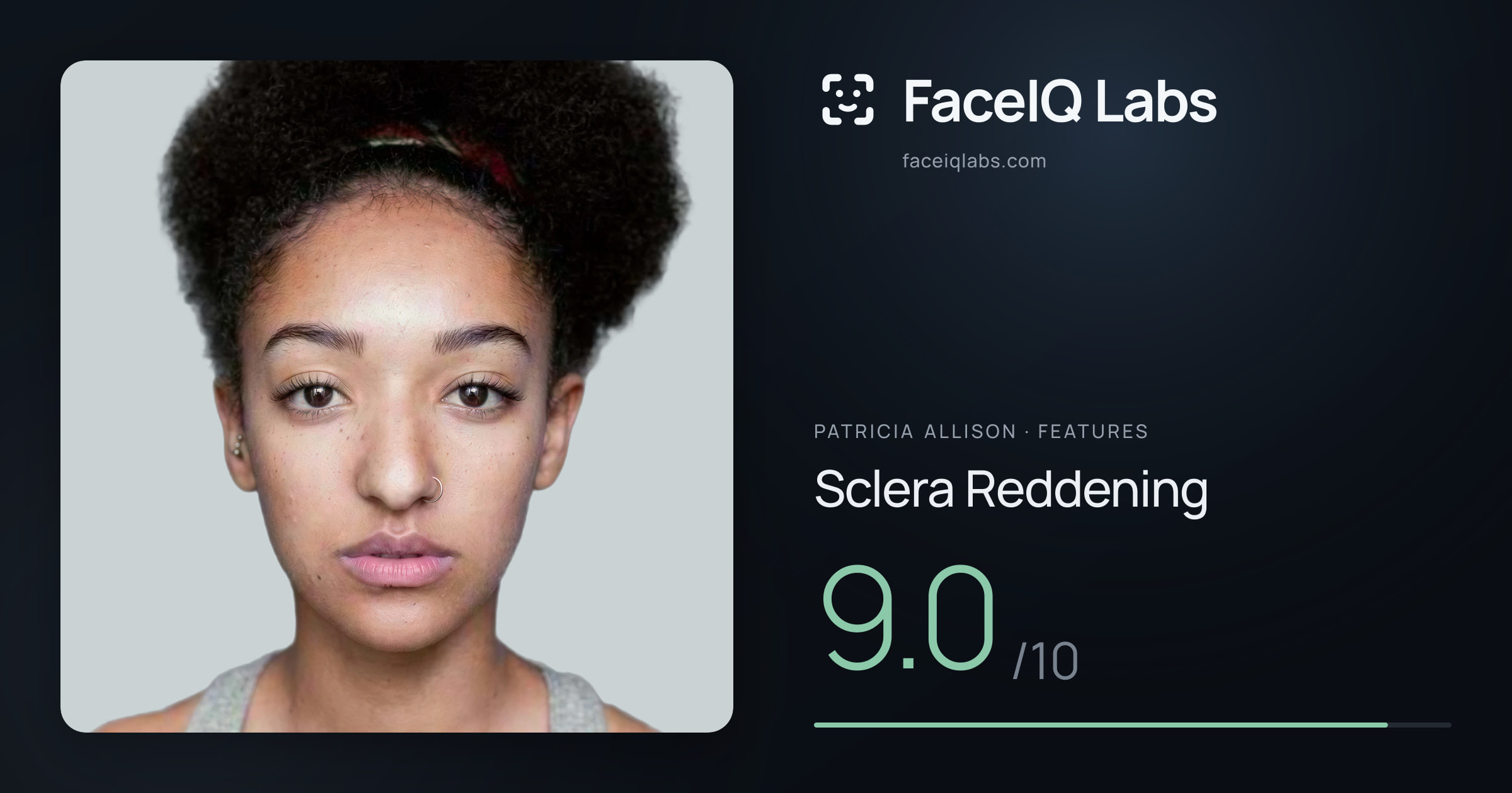 Patricia Allison Sclera Reddening: 9.0/10, drawn on the photo