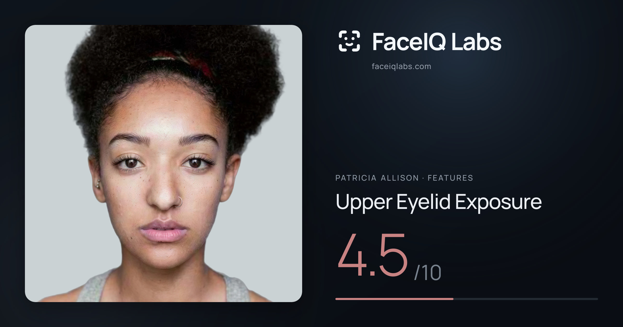 Patricia Allison Upper Eyelid Exposure: 4.5/10, drawn on the photo