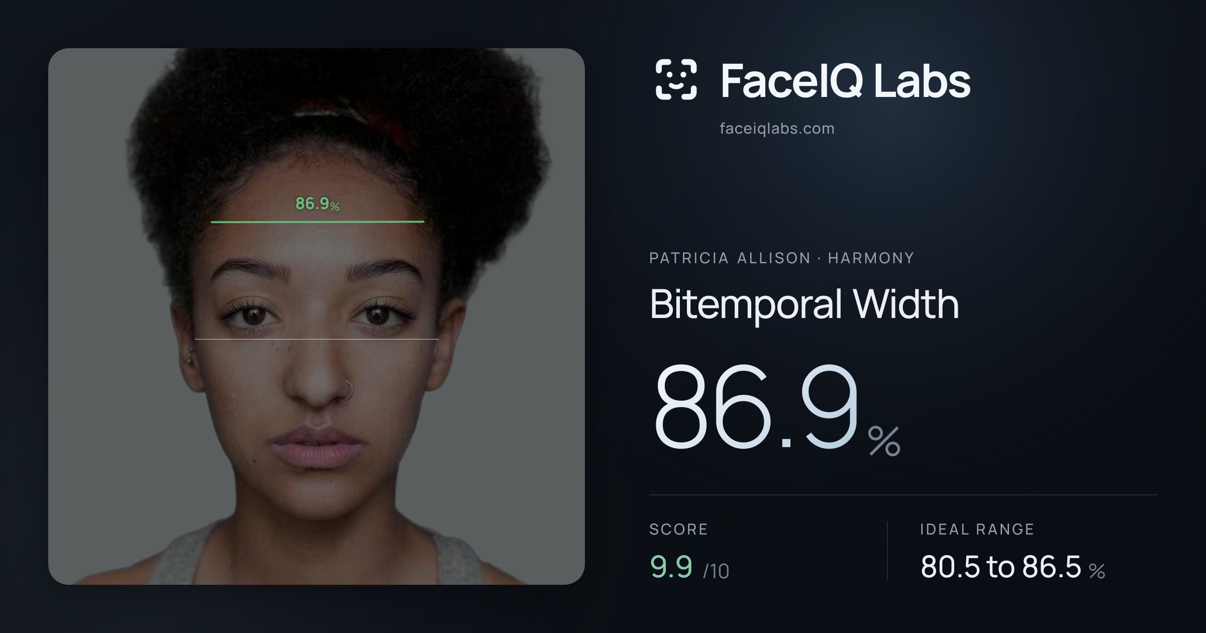 Patricia Allison Bitemporal Width: 86.9%, drawn on the photo
