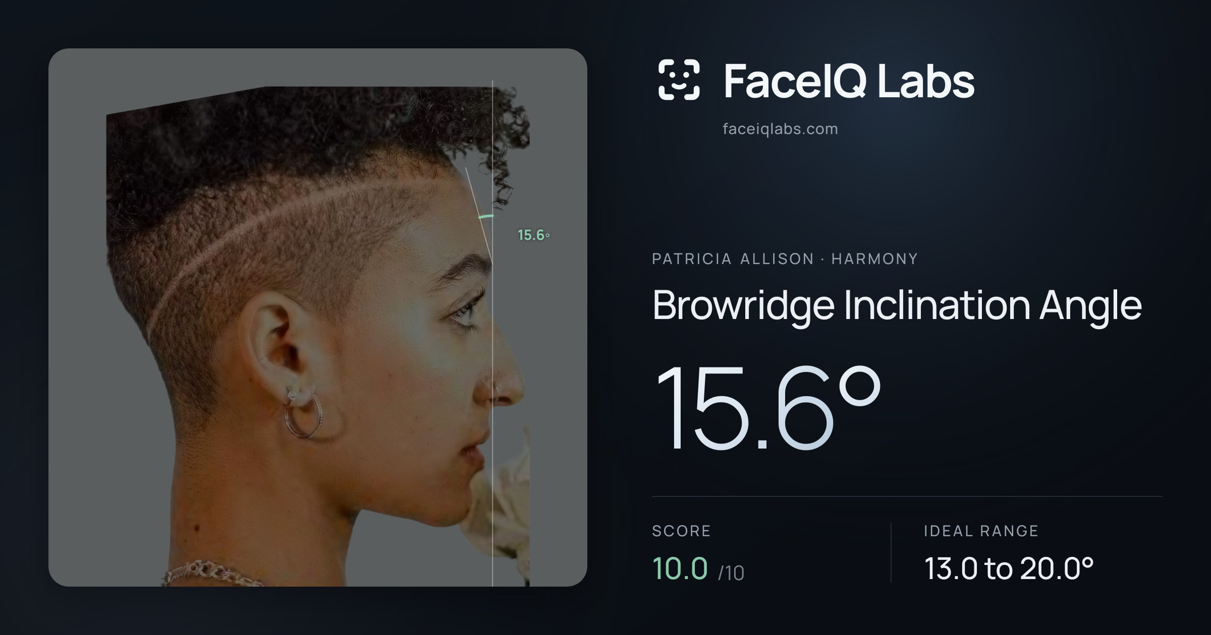 Patricia Allison Browridge Inclination Angle: 15.6°, drawn on the photo