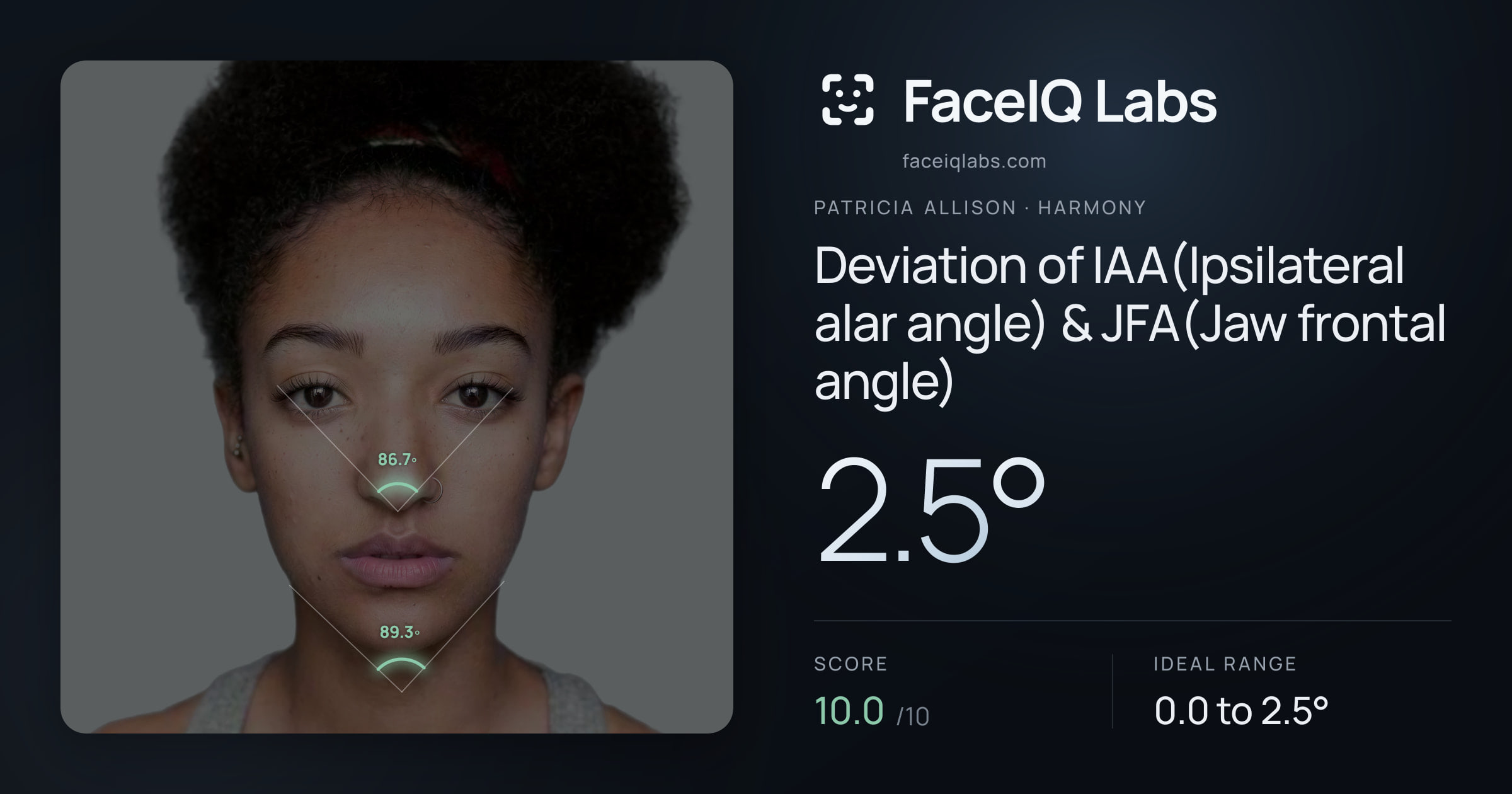 Patricia Allison Deviation of IAA(Ipsilateral alar angle) & JFA(Jaw frontal angle): 2.5°, drawn on the photo