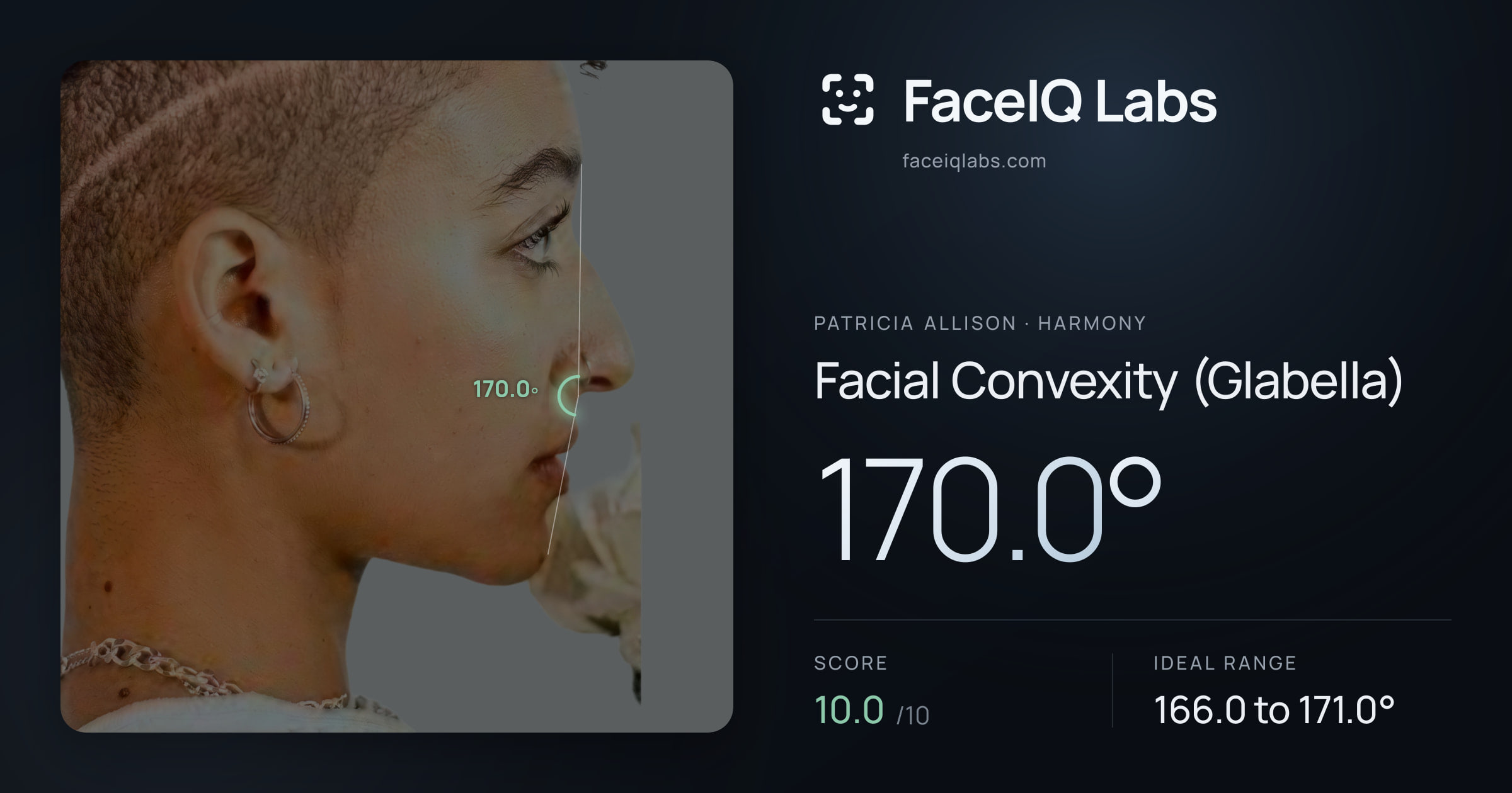 Patricia Allison Facial Convexity (Glabella): 170.0°, drawn on the photo