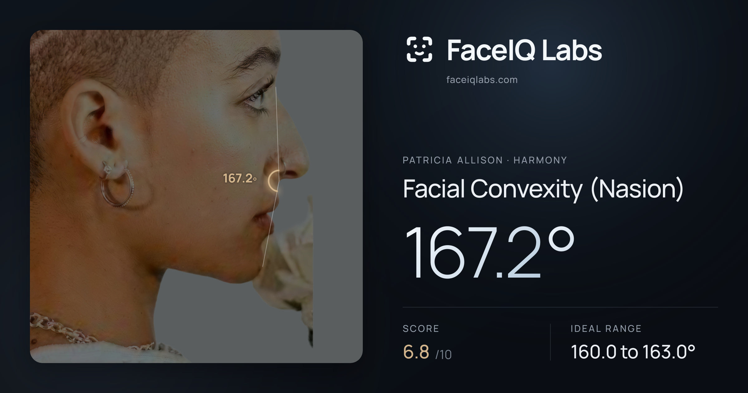 Patricia Allison Facial Convexity (Nasion): 167.2°, drawn on the photo