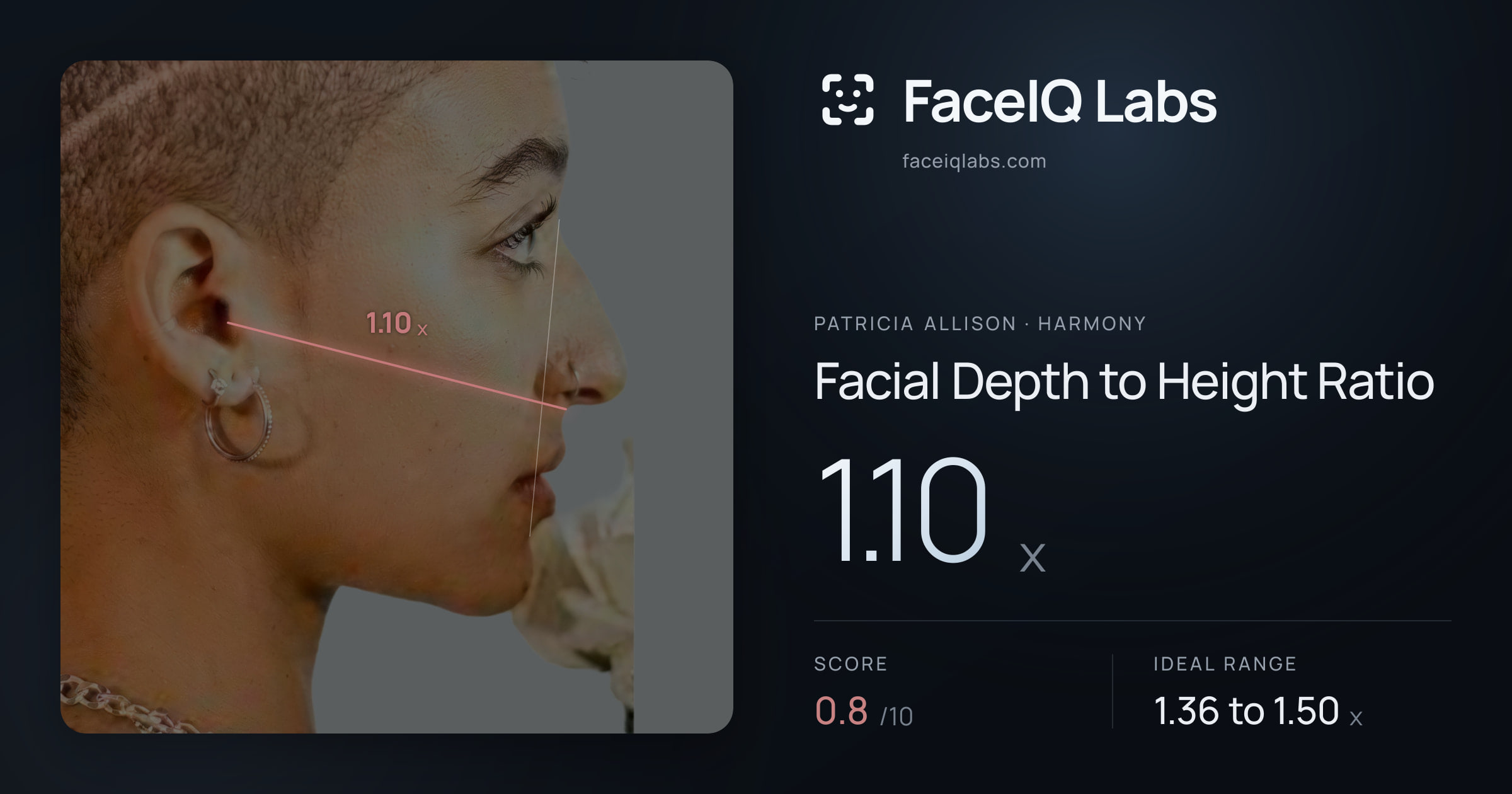 Patricia Allison Facial Depth to Height Ratio: 1.10x, drawn on the photo