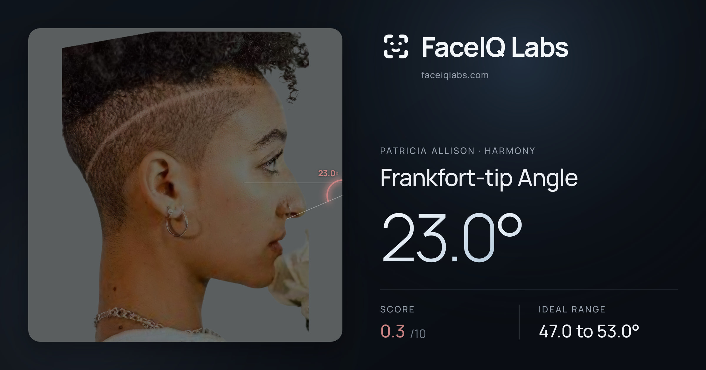 Patricia Allison Frankfort-tip Angle: 23.0°, drawn on the photo