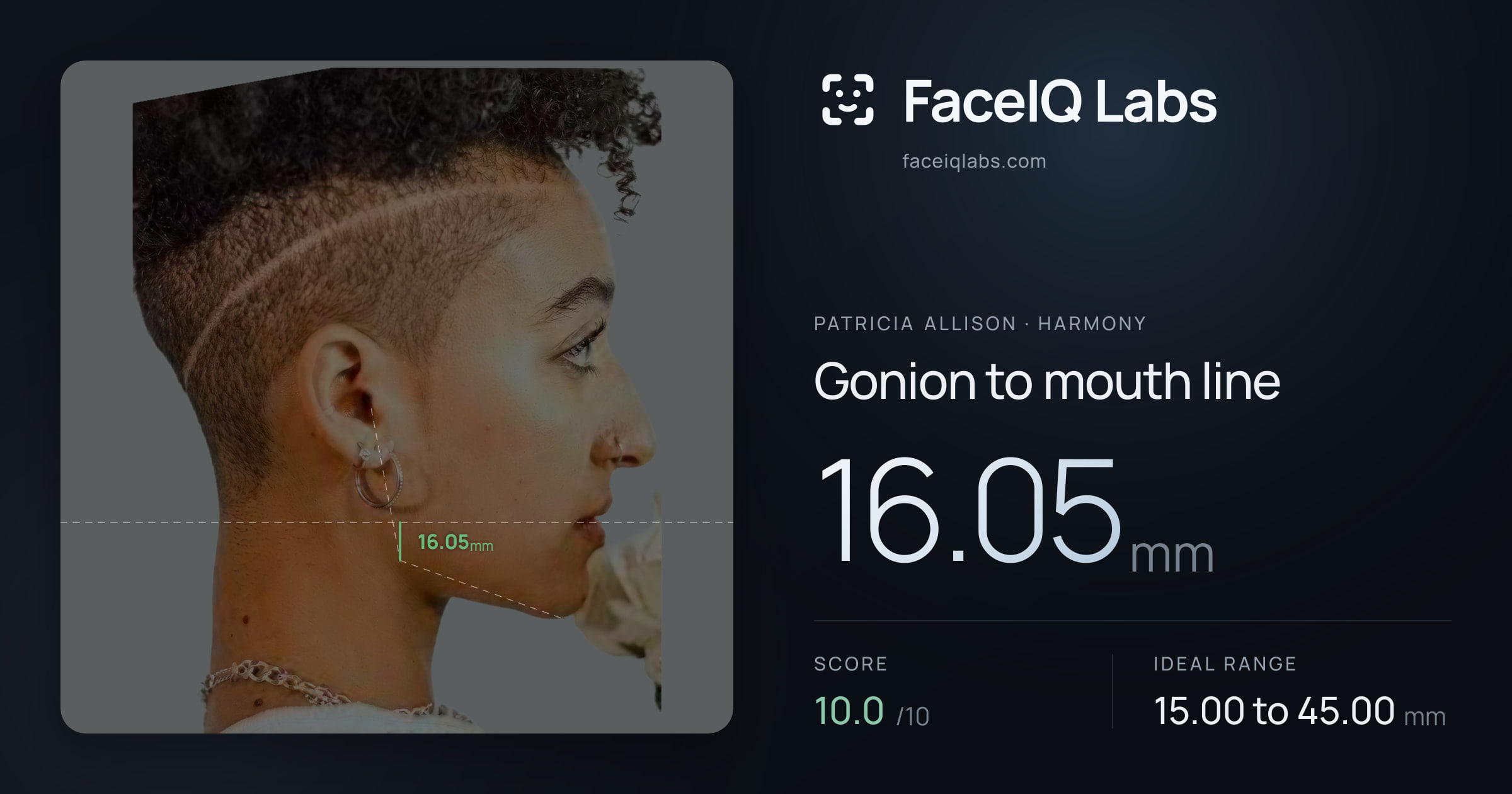 Patricia Allison Gonion to mouth line: 16.05mm, drawn on the photo