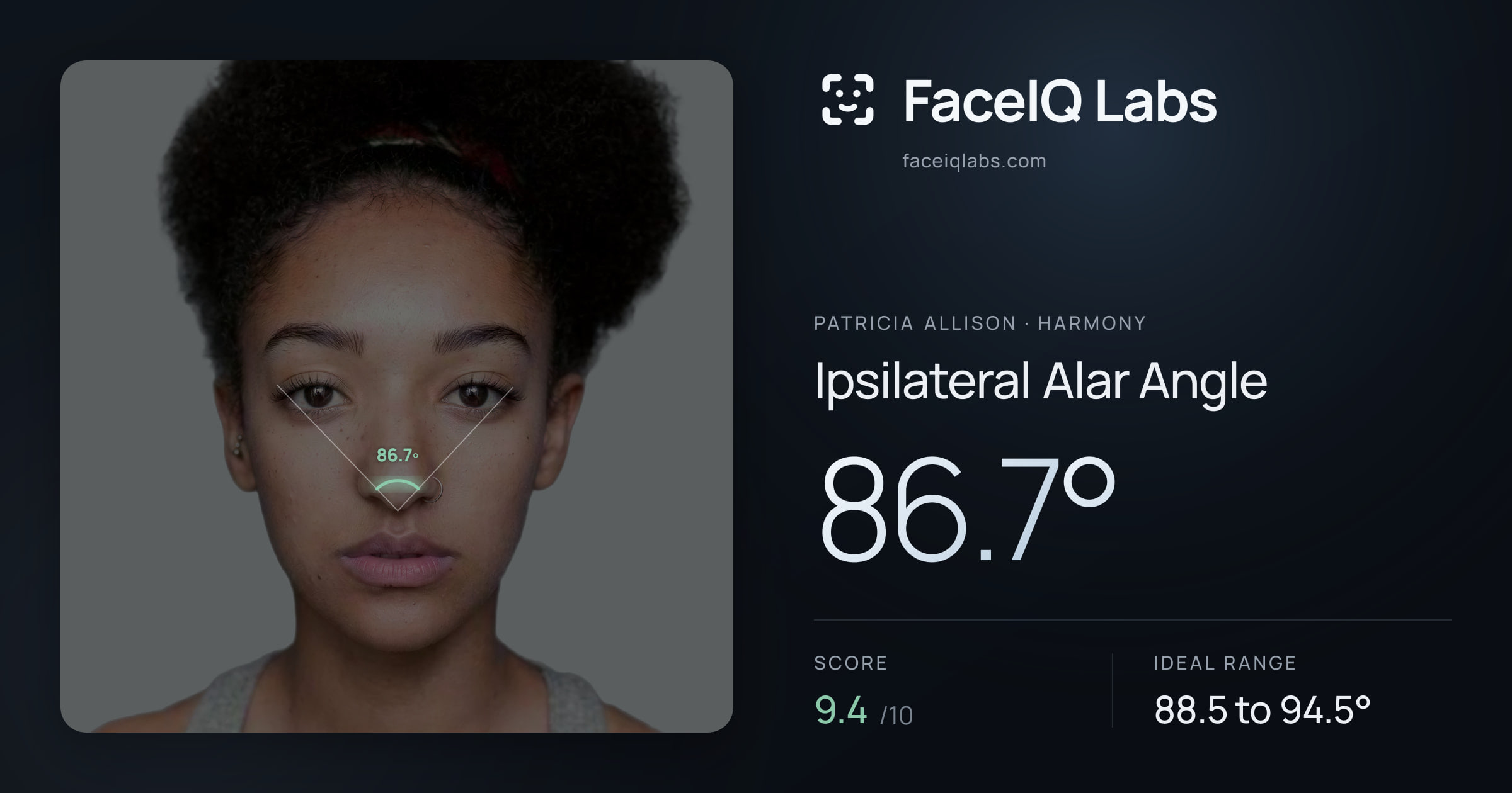 Patricia Allison Ipsilateral Alar Angle: 86.7°, drawn on the photo