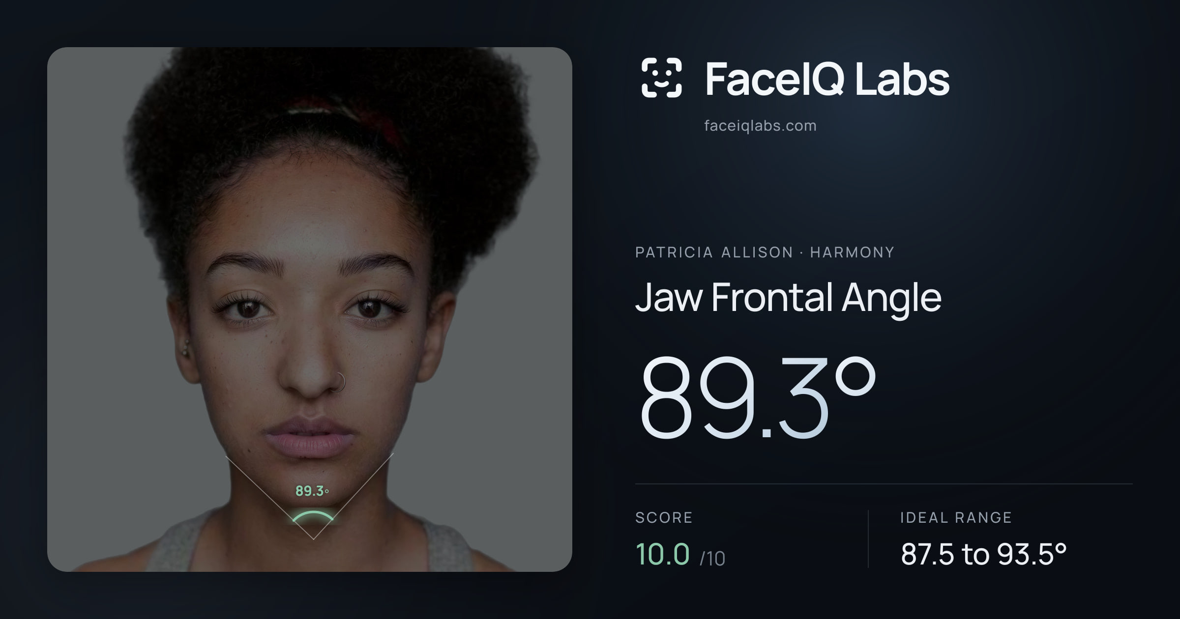 Patricia Allison Jaw Frontal Angle: 89.3°, drawn on the photo