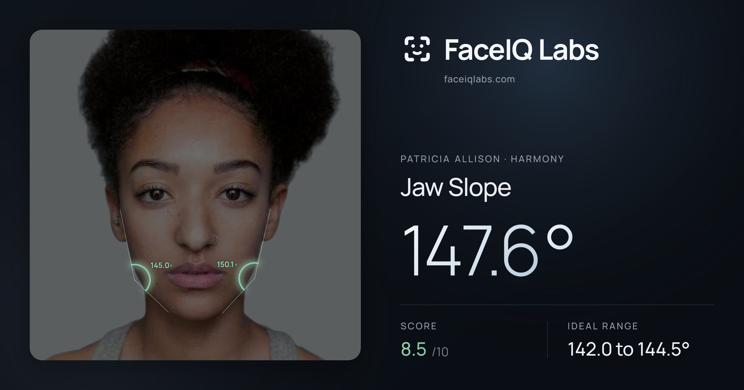 Patricia Allison Jaw Slope: 147.6°, drawn on the photo