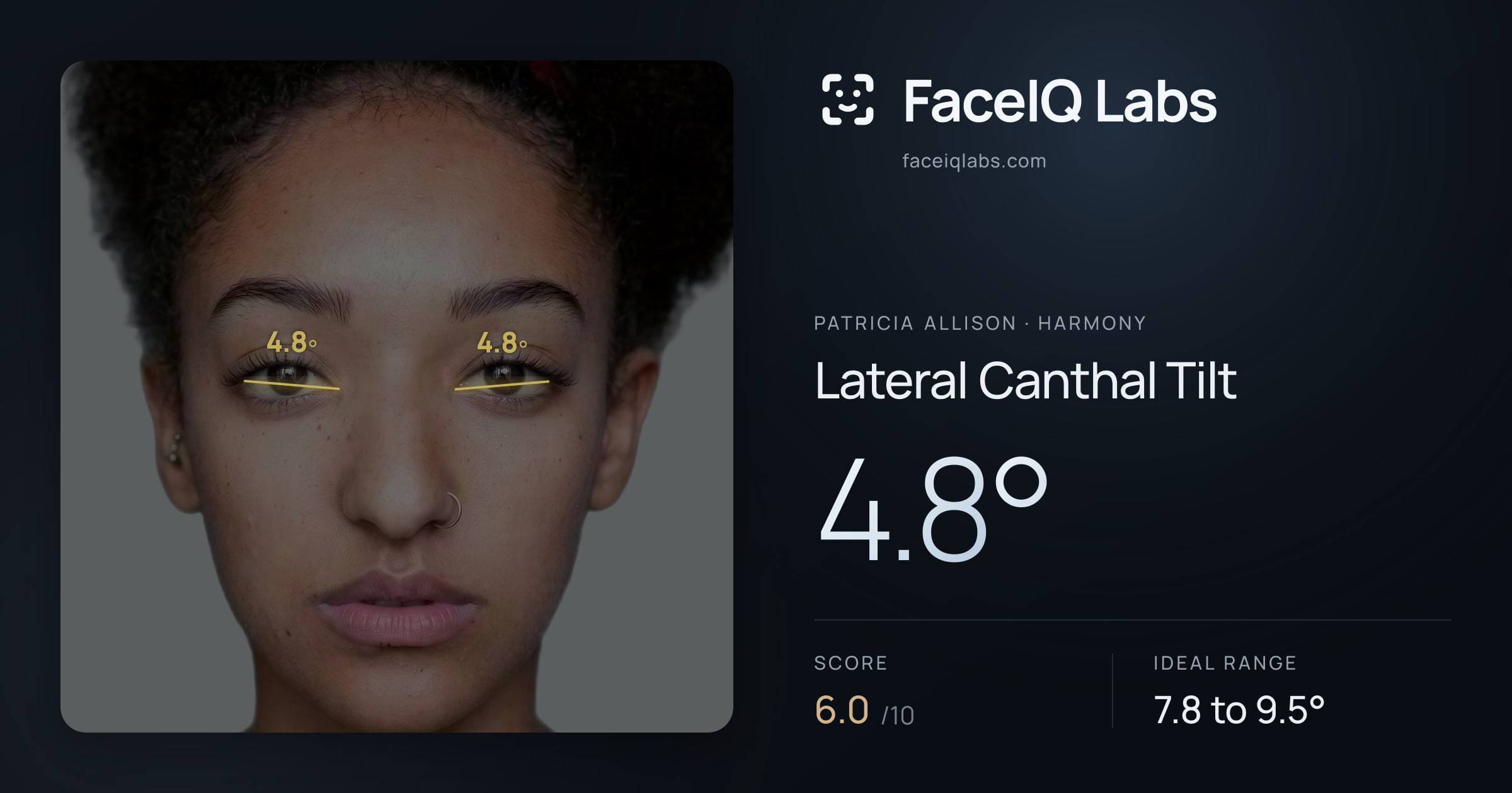 Patricia Allison Lateral Canthal Tilt: 4.8°, drawn on the photo