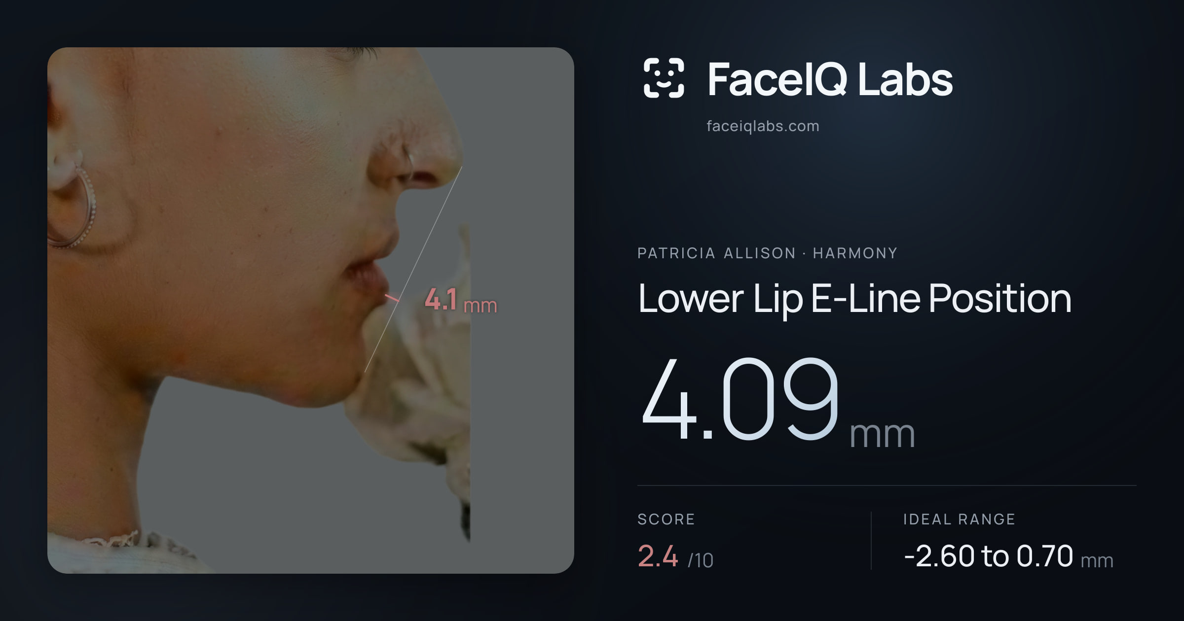 Patricia Allison Lower Lip E-Line Position: 4.09mm, drawn on the photo