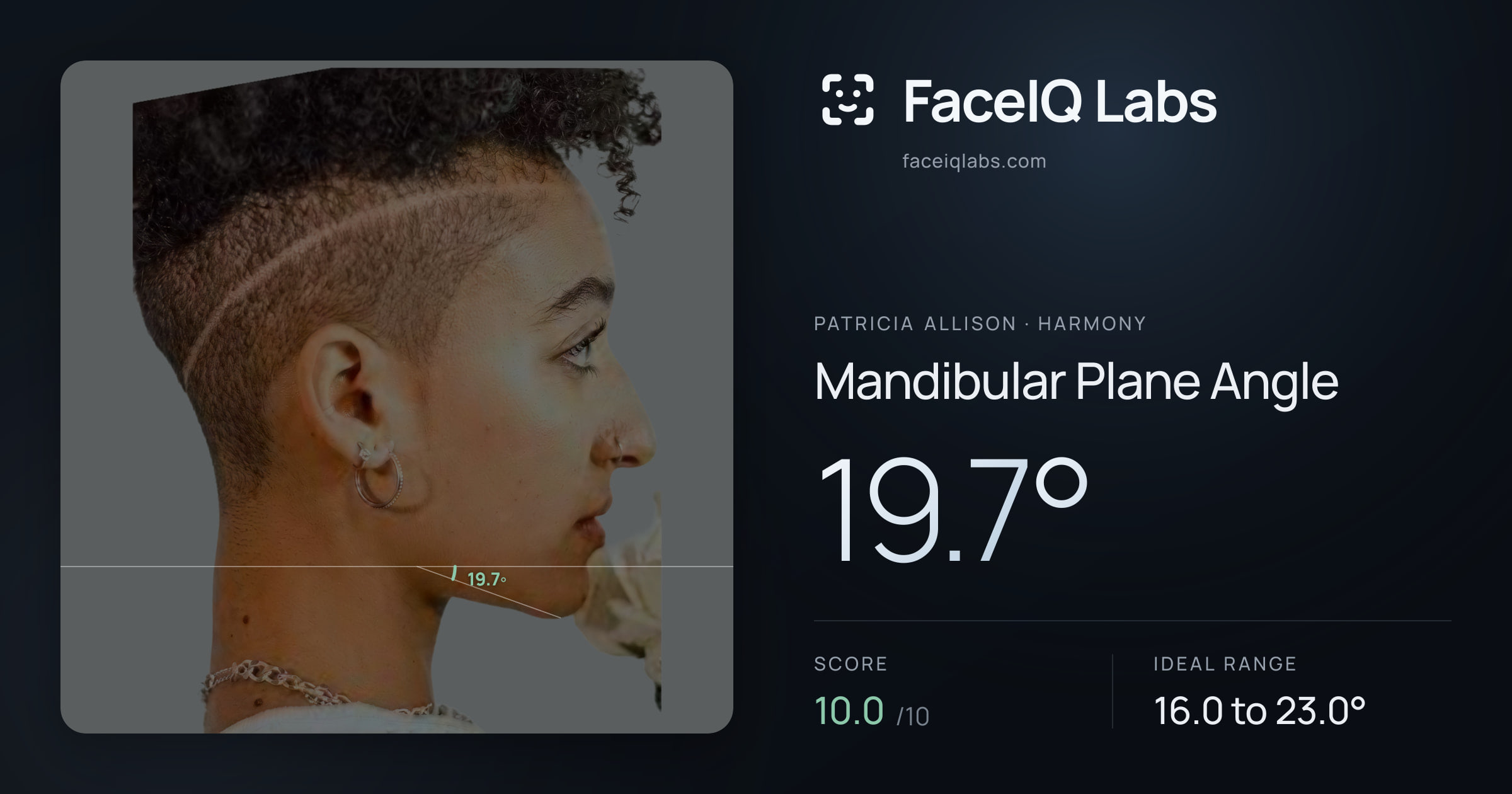 Patricia Allison Mandibular Plane Angle: 19.7°, drawn on the photo