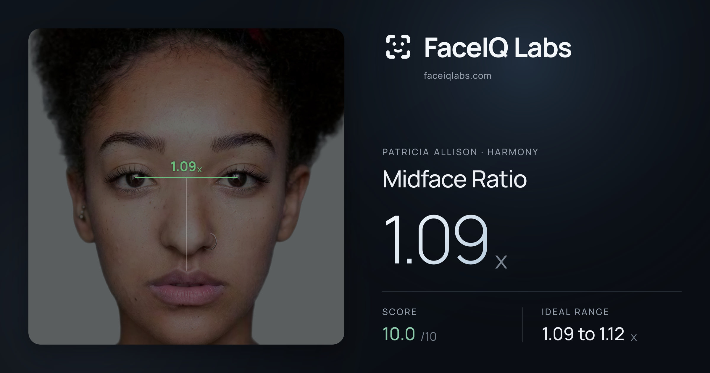 Patricia Allison Midface Ratio: 1.09x, drawn on the photo