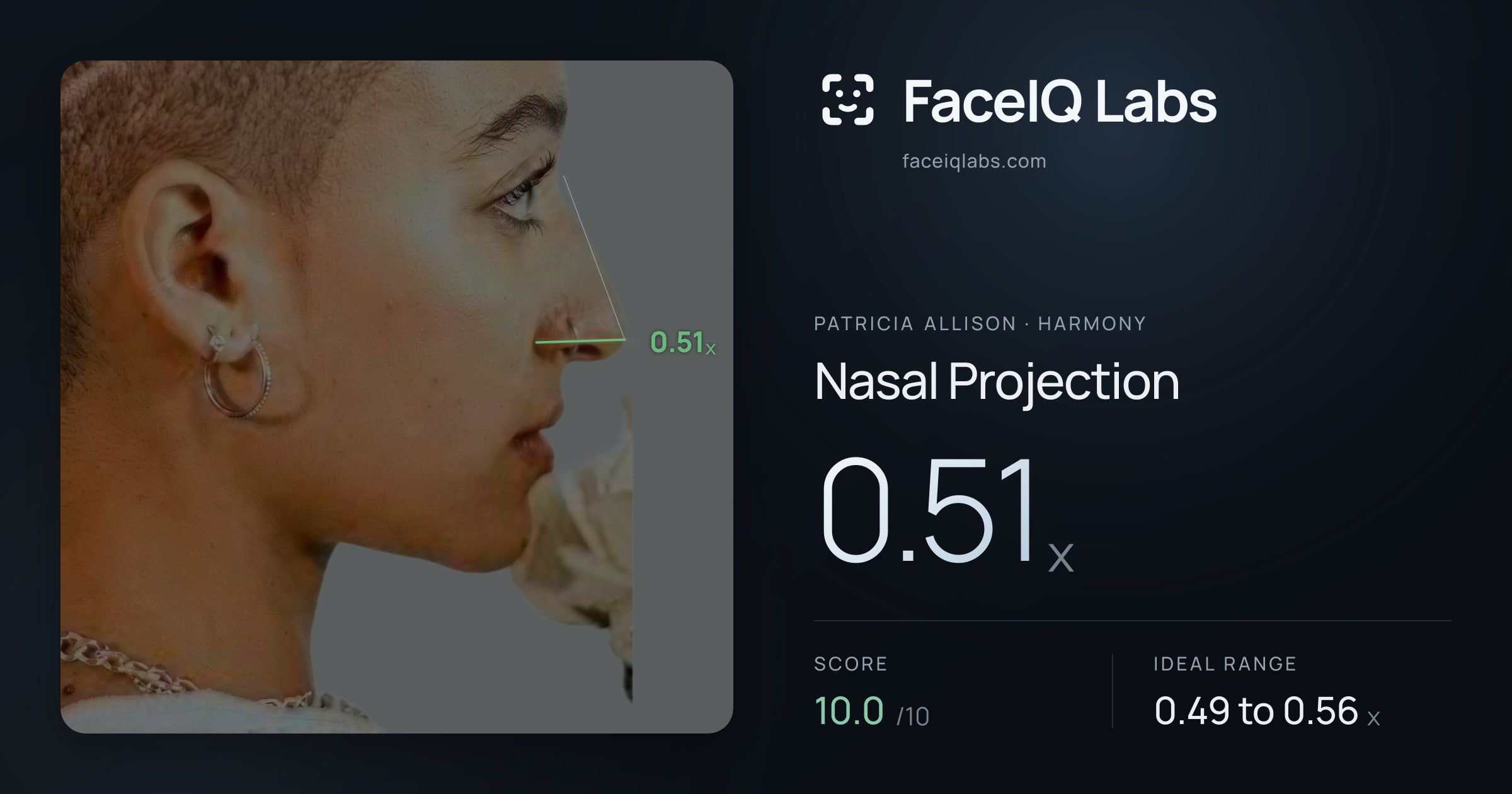 Patricia Allison Nasal Projection: 0.51x, drawn on the photo