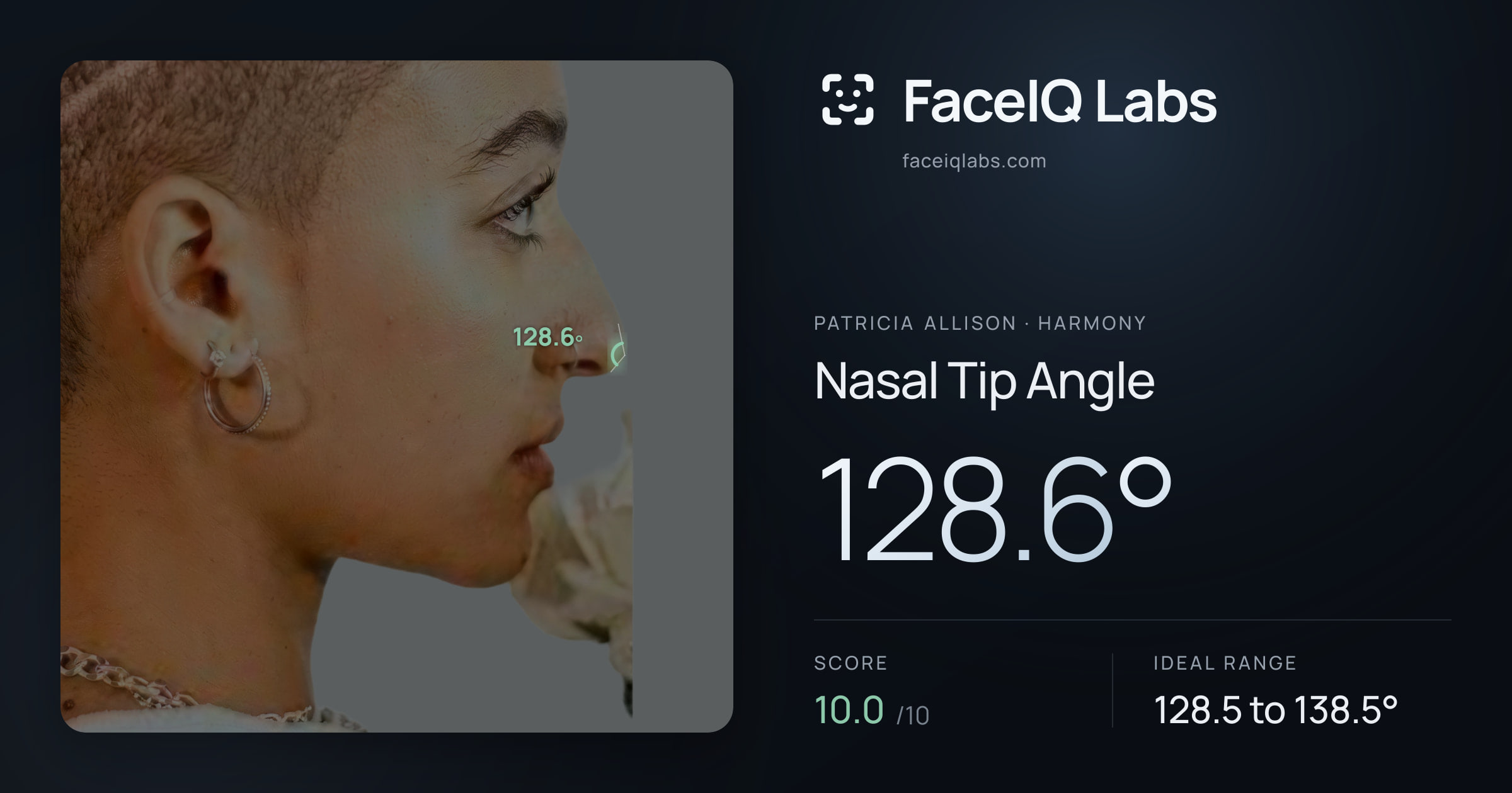 Patricia Allison Nasal Tip Angle: 128.6°, drawn on the photo