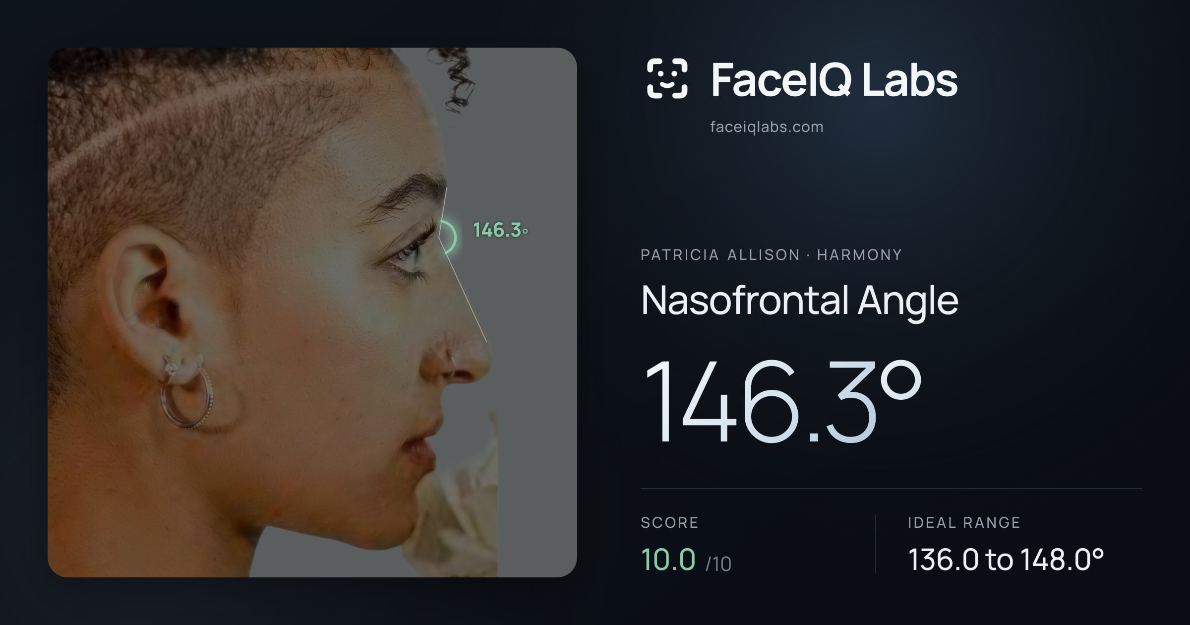 Patricia Allison Nasofrontal Angle: 146.3°, drawn on the photo