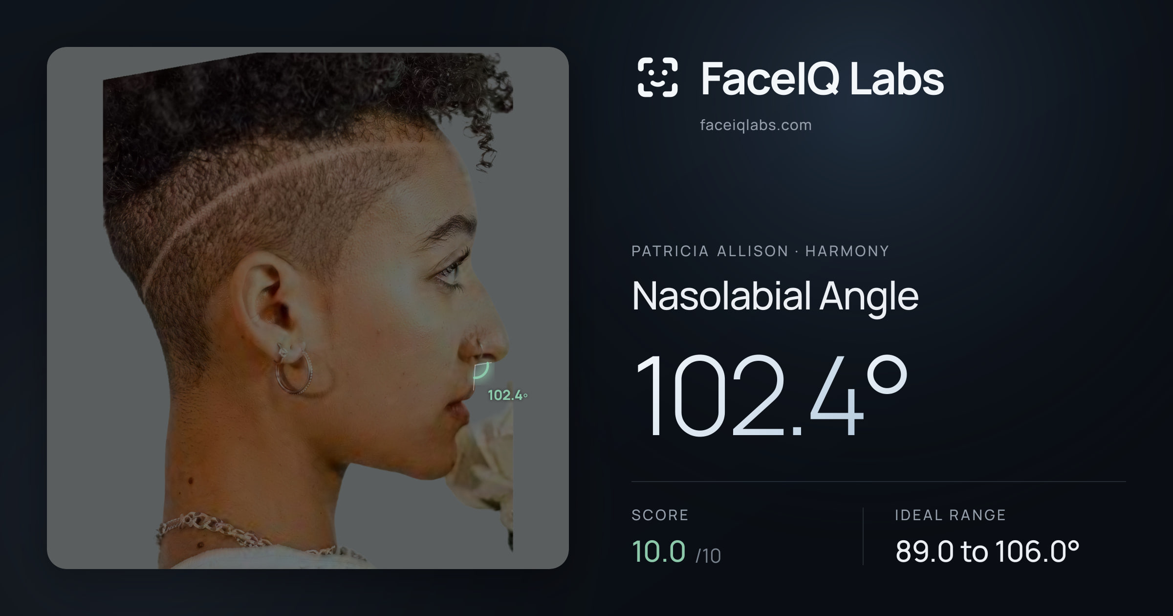 Patricia Allison Nasolabial Angle: 102.4°, drawn on the photo