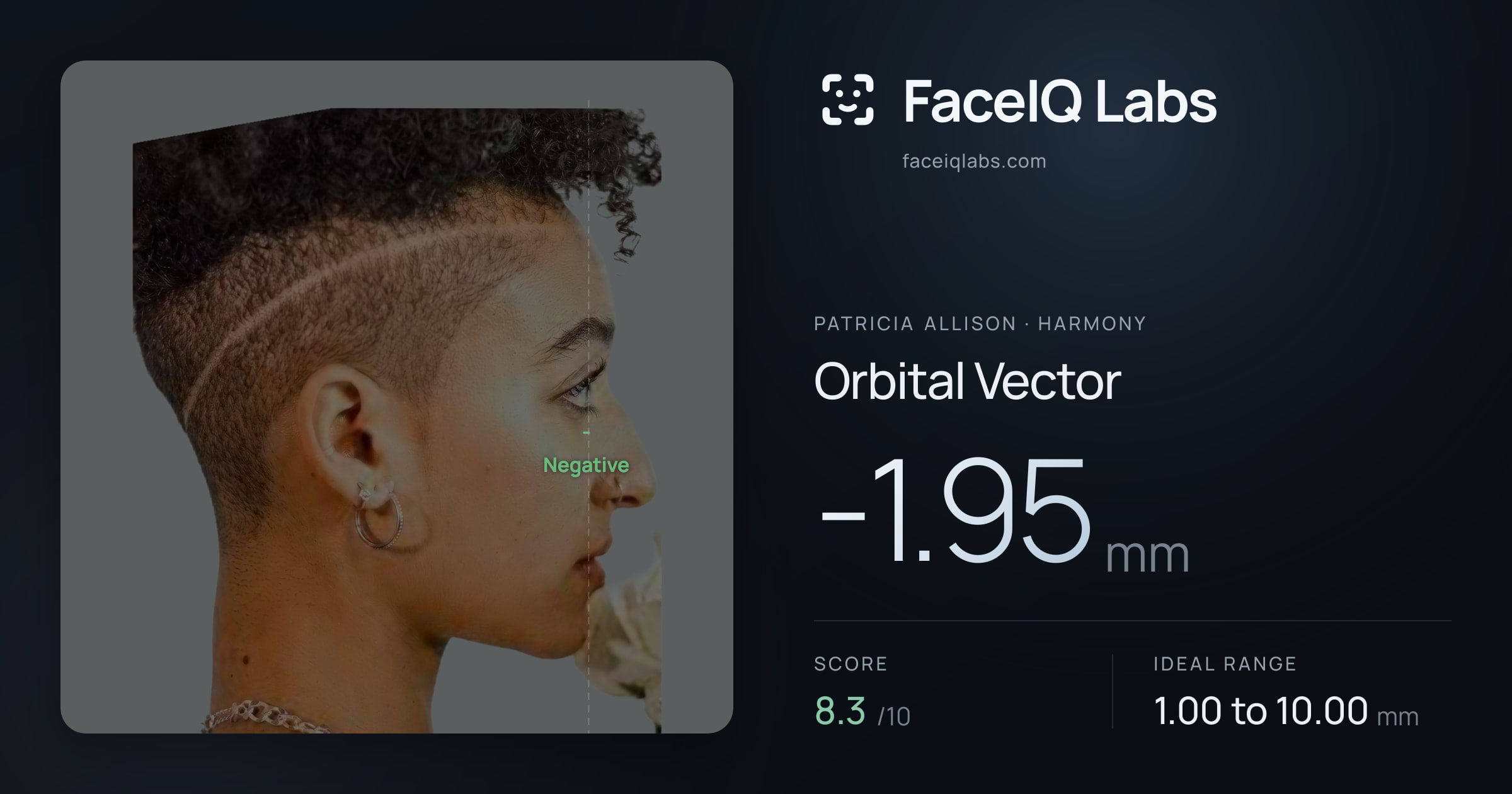 Patricia Allison Orbital Vector: -1.95mm, drawn on the photo