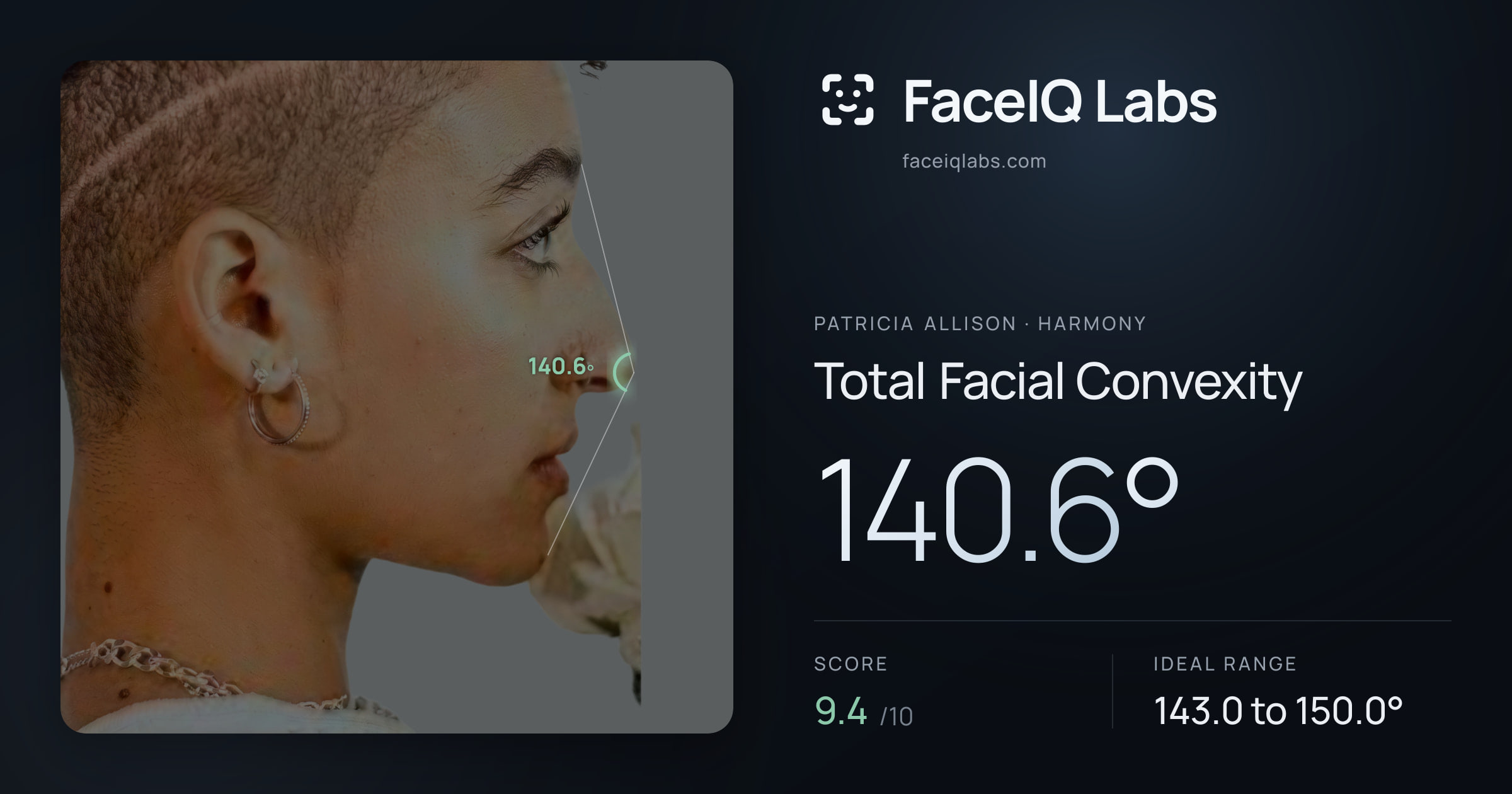 Patricia Allison Total Facial Convexity: 140.6°, drawn on the photo