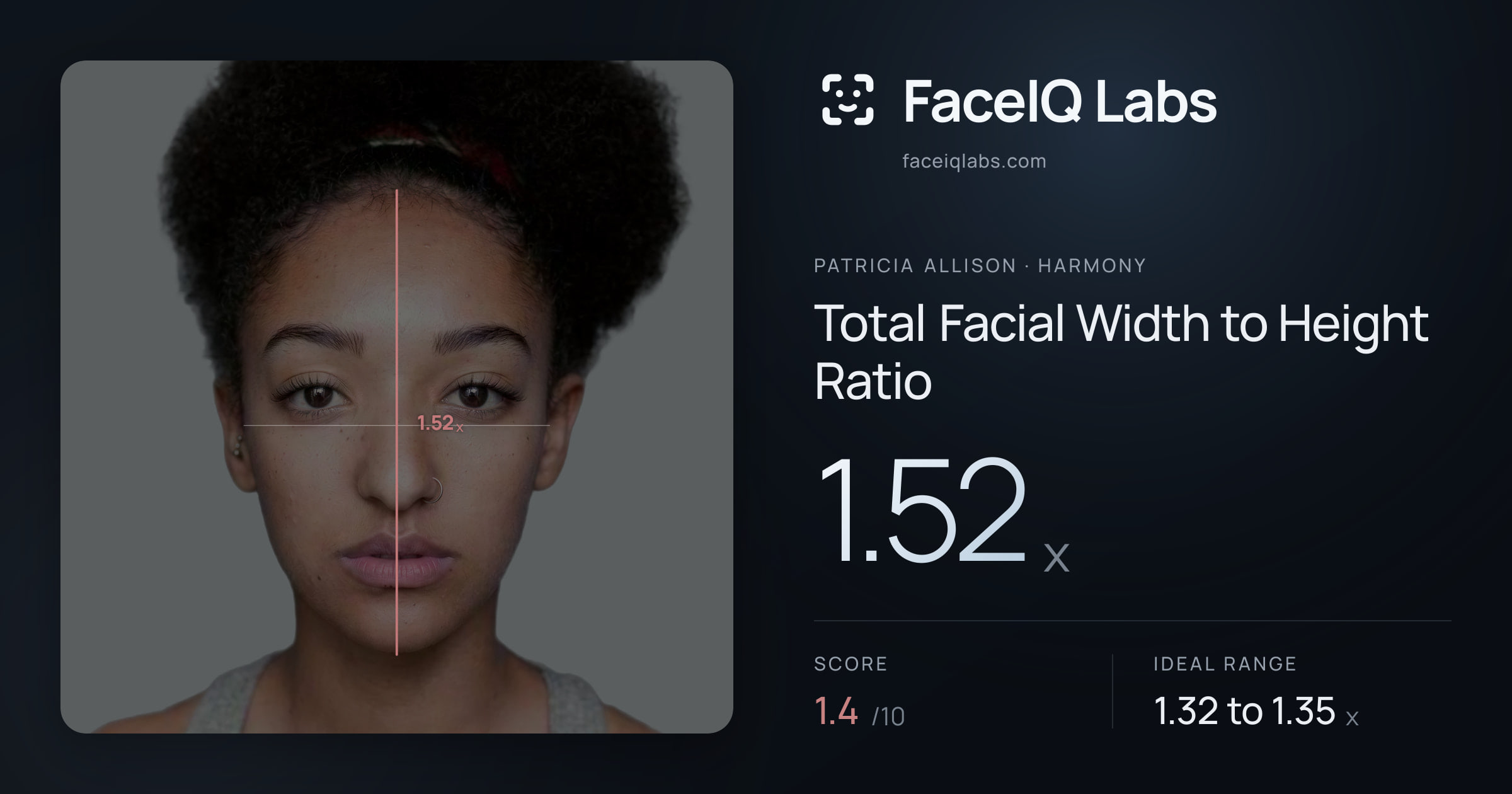 Patricia Allison Total Facial Width to Height Ratio: 1.52x, drawn on the photo