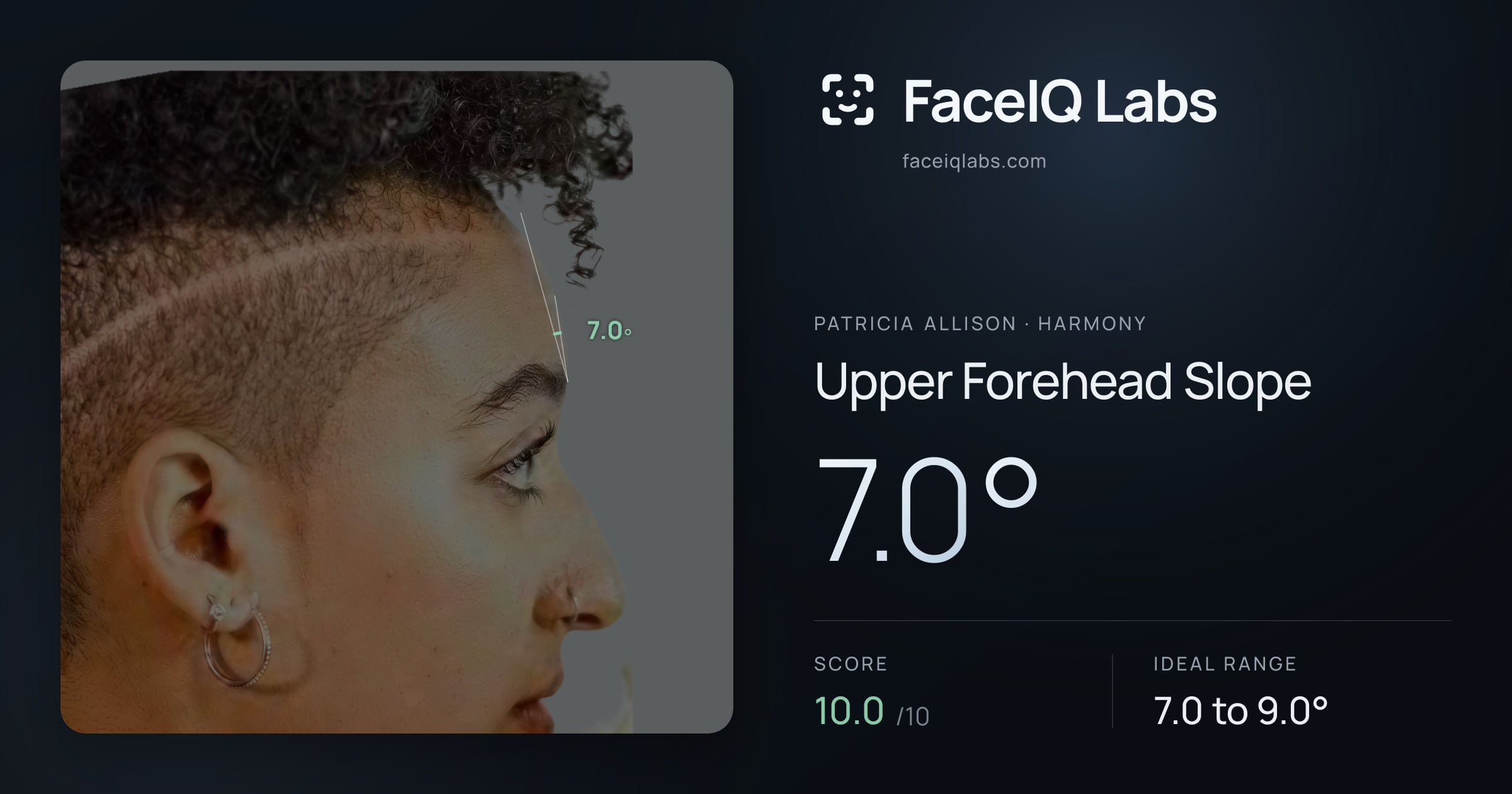 Patricia Allison Upper Forehead Slope: 7.0°, drawn on the photo