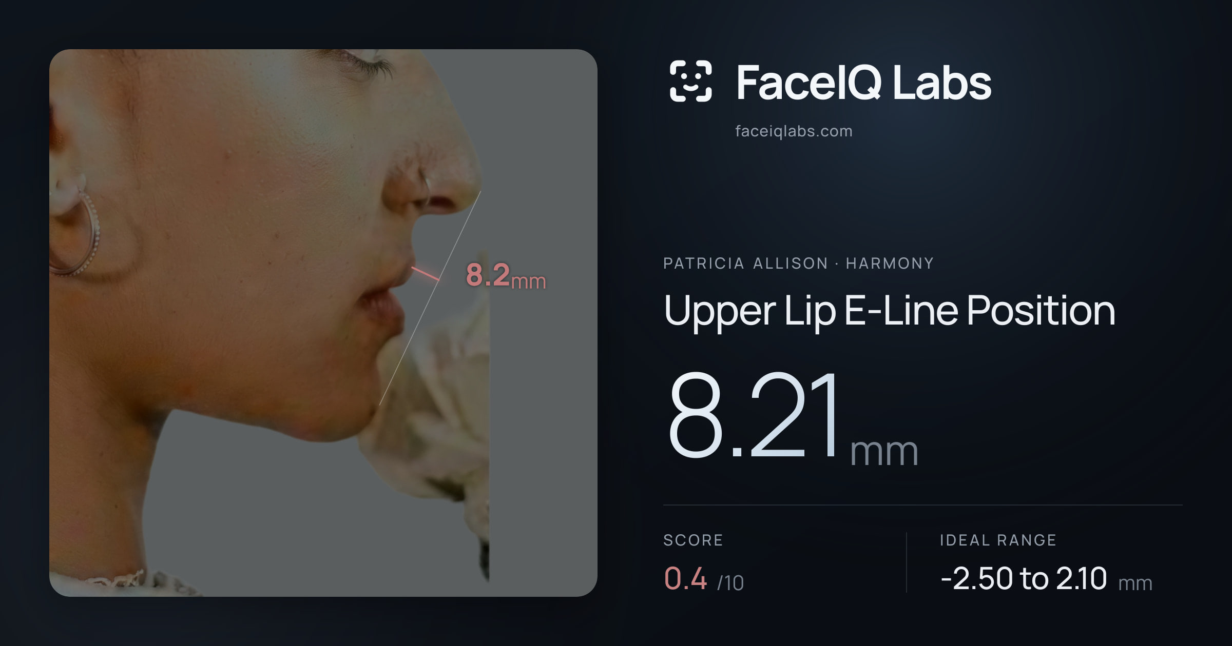 Patricia Allison Upper Lip E-Line Position: 8.21mm, drawn on the photo