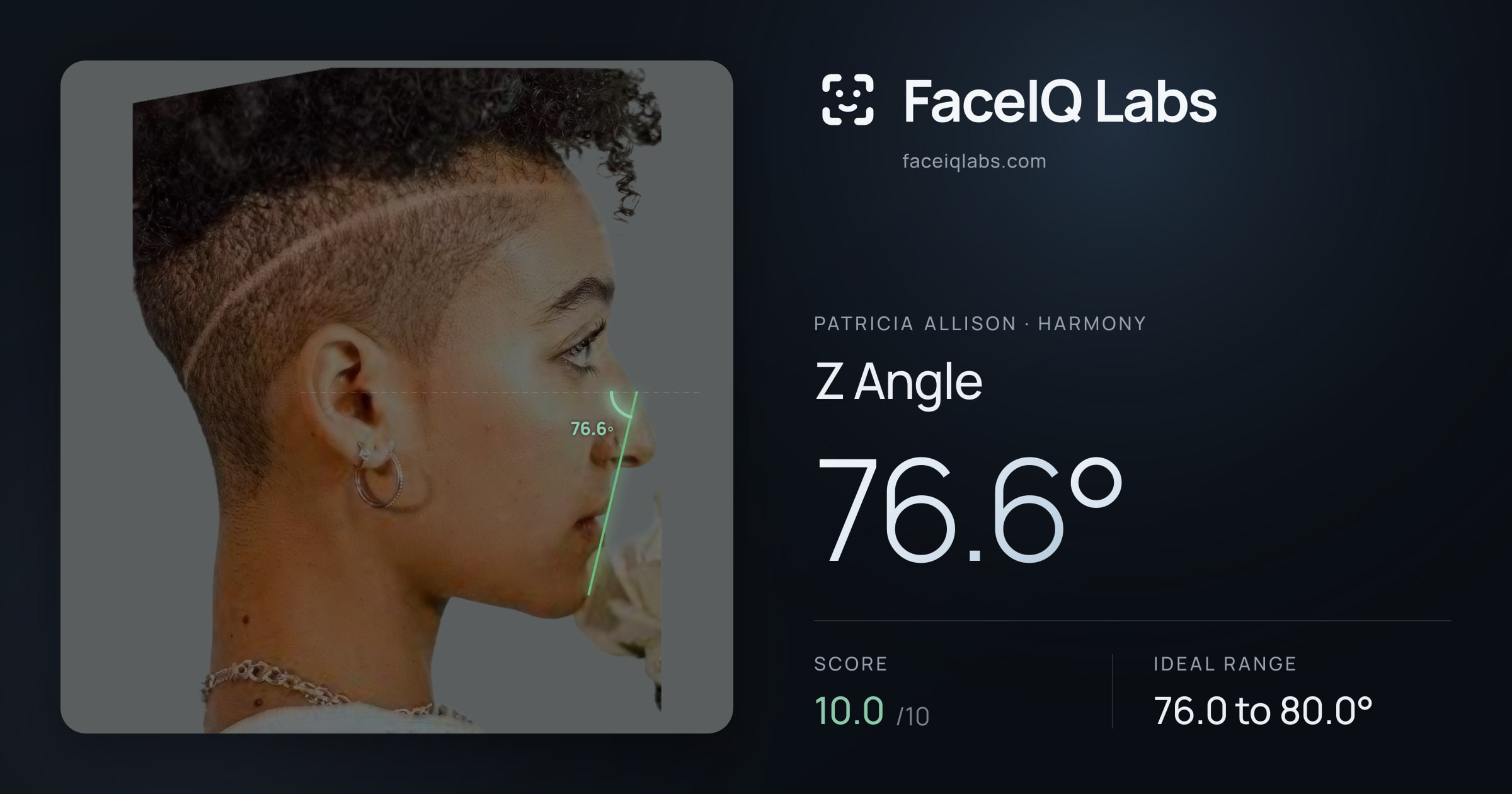 Patricia Allison Z Angle: 76.6°, drawn on the photo
