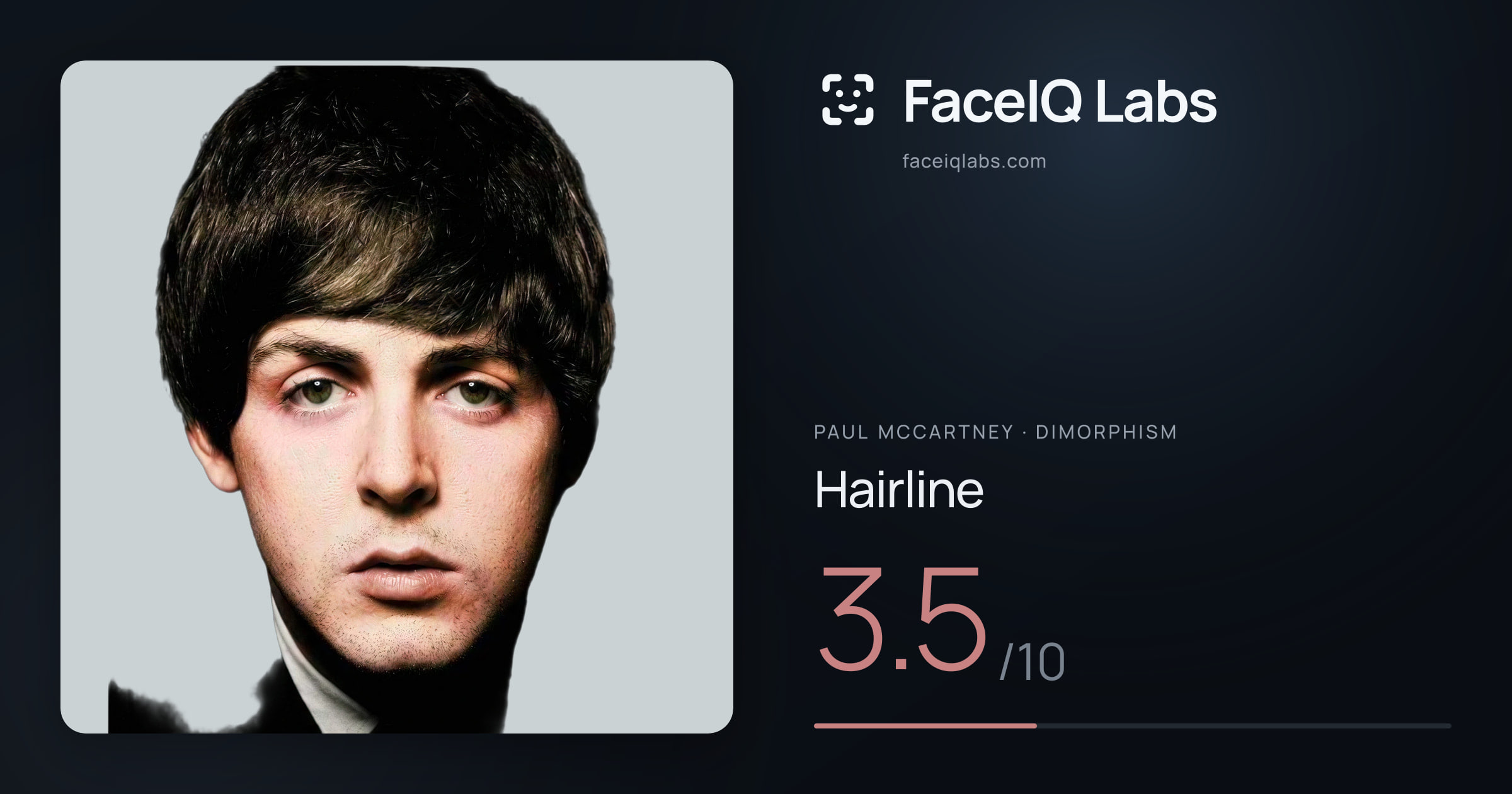 Paul McCartney Hairline: 3.5/10, drawn on the photo