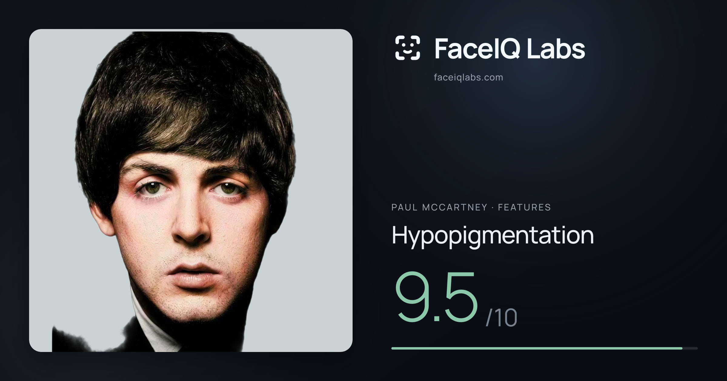 Paul McCartney Hypopigmentation: 9.5/10, drawn on the photo