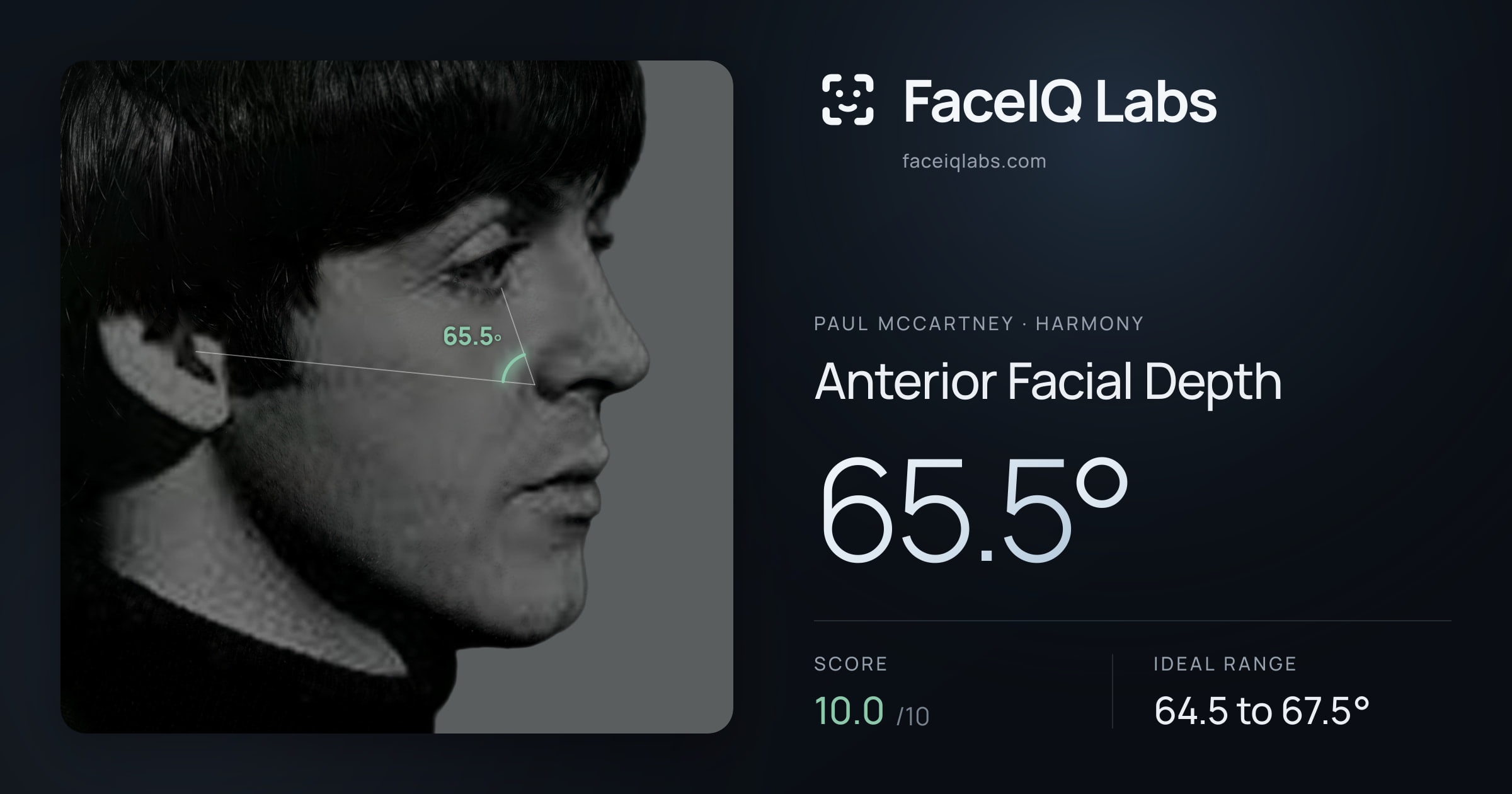 Paul McCartney Anterior Facial Depth: 65.5°, drawn on the photo