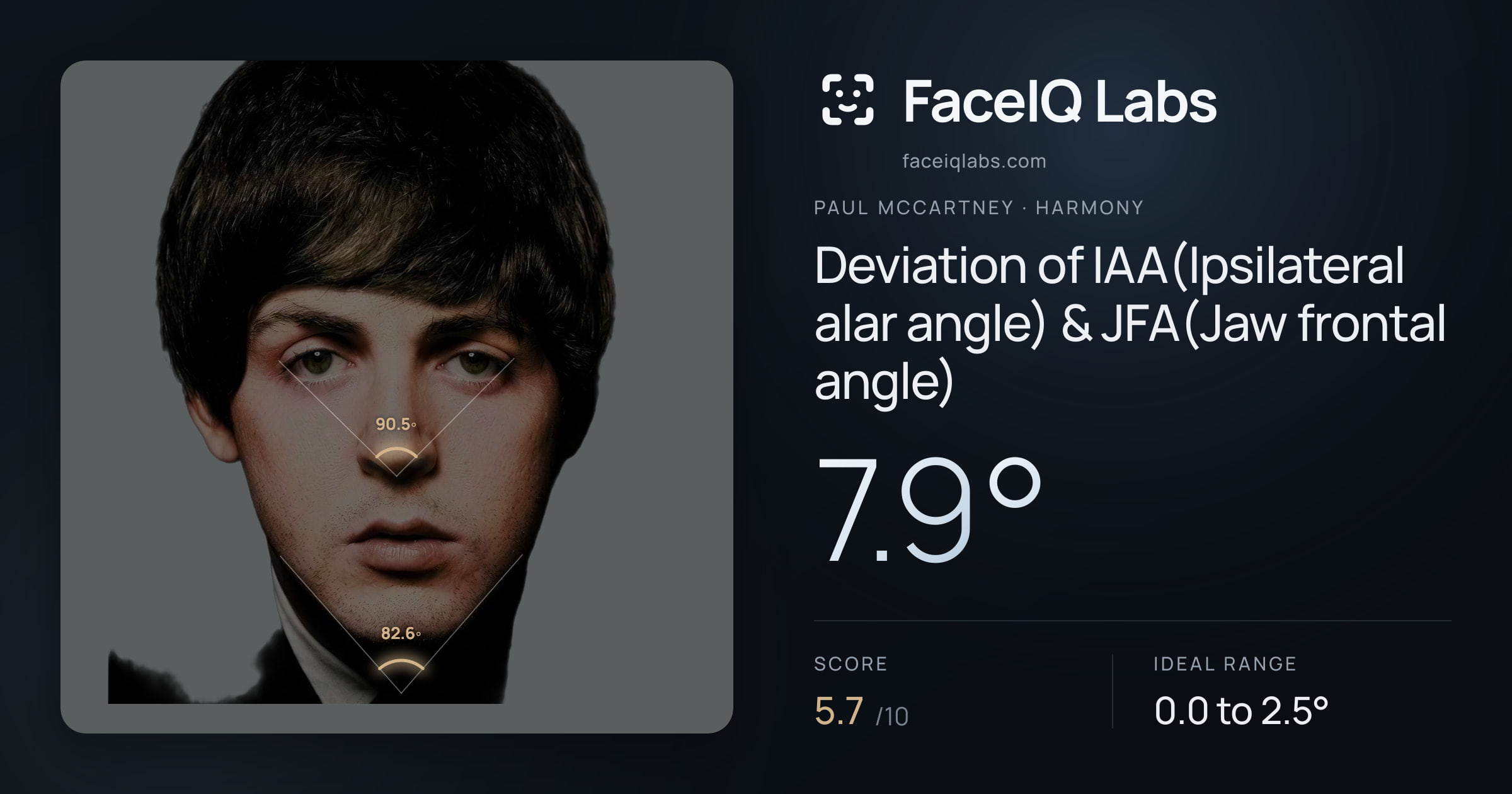 Paul McCartney Deviation of IAA(Ipsilateral alar angle) & JFA(Jaw frontal angle): 7.9°, drawn on the photo