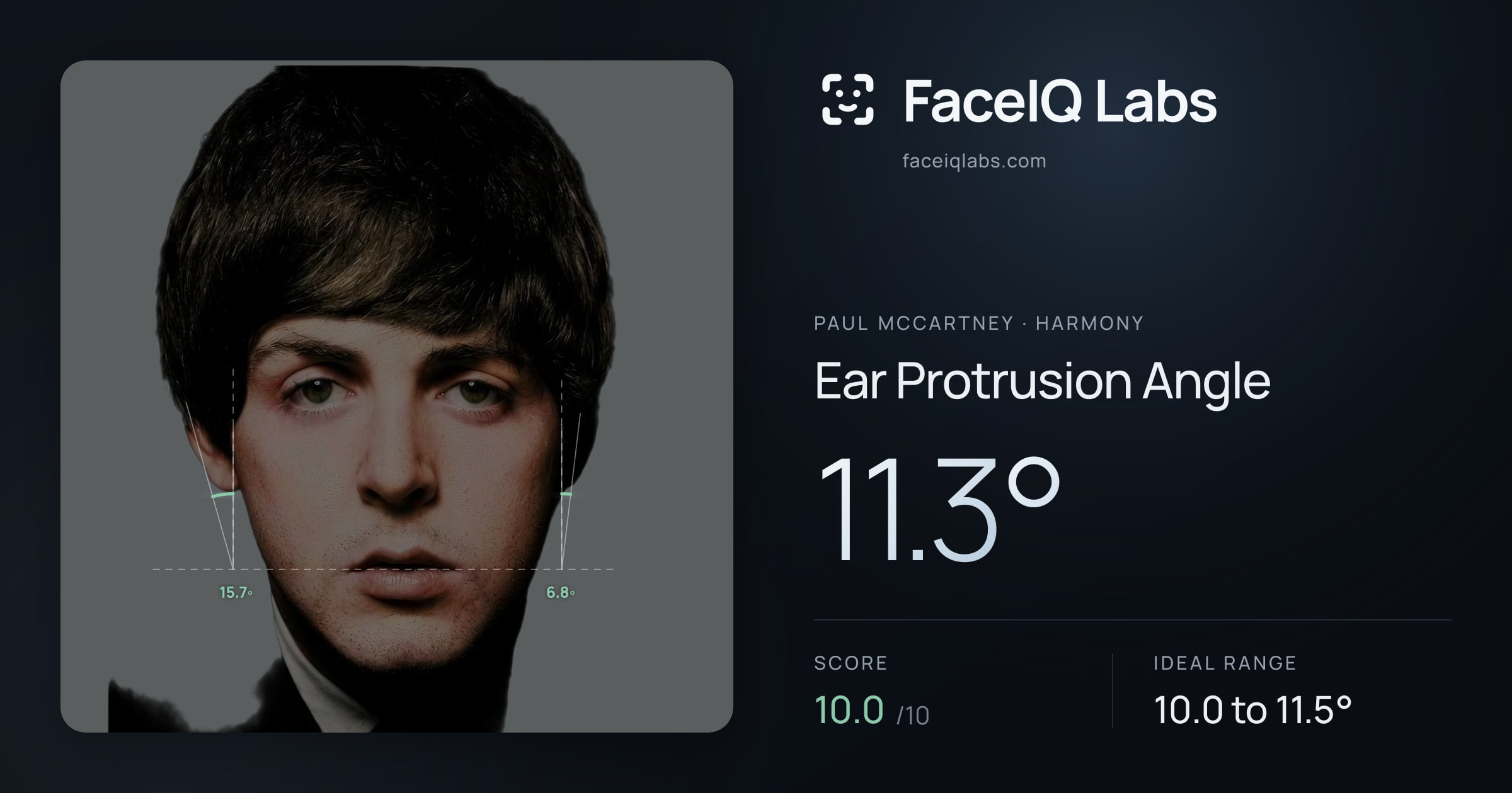 Paul McCartney Ear Protrusion Angle: 11.3°, drawn on the photo