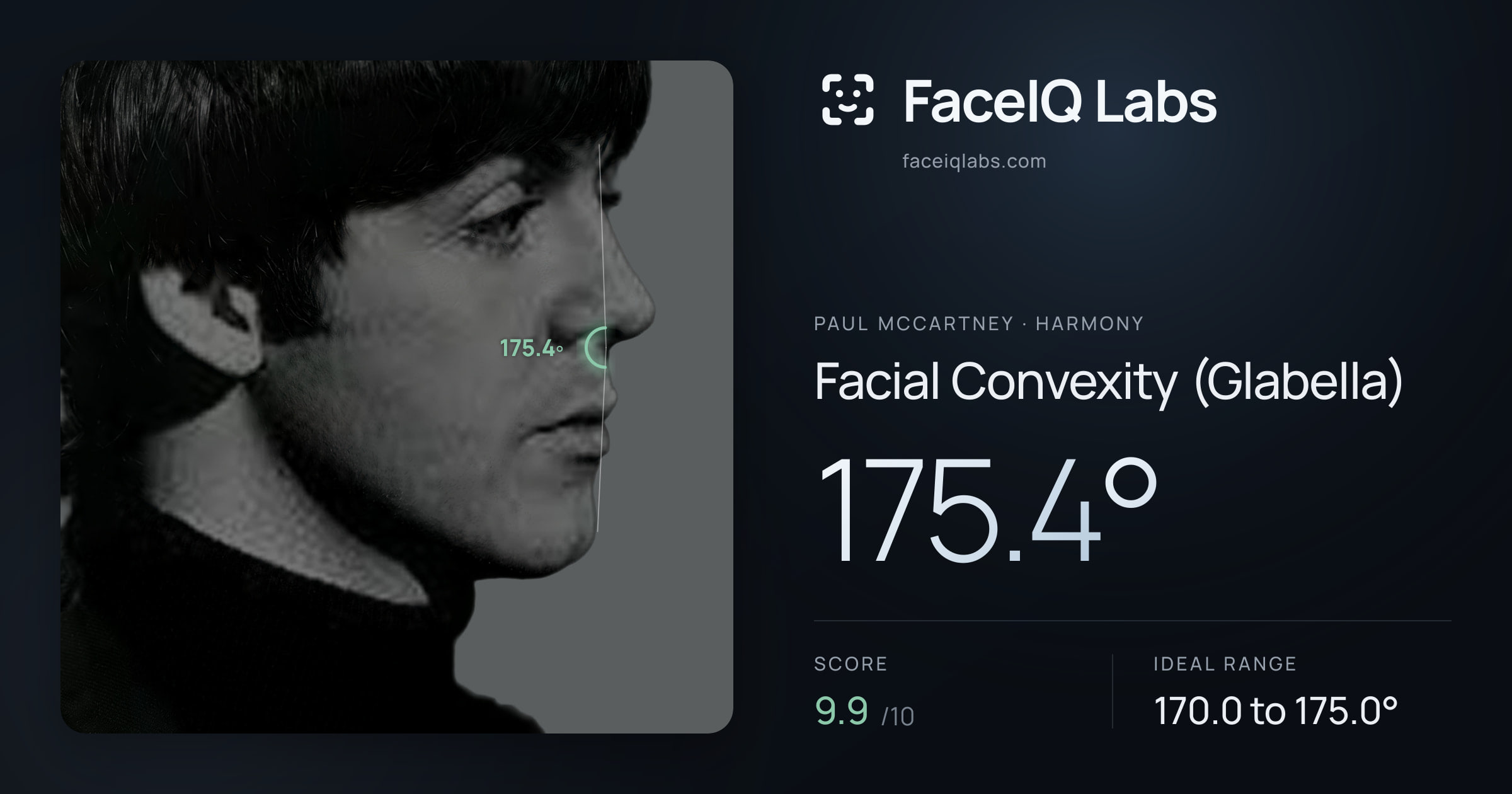 Paul McCartney Facial Convexity (Glabella): 175.4°, drawn on the photo