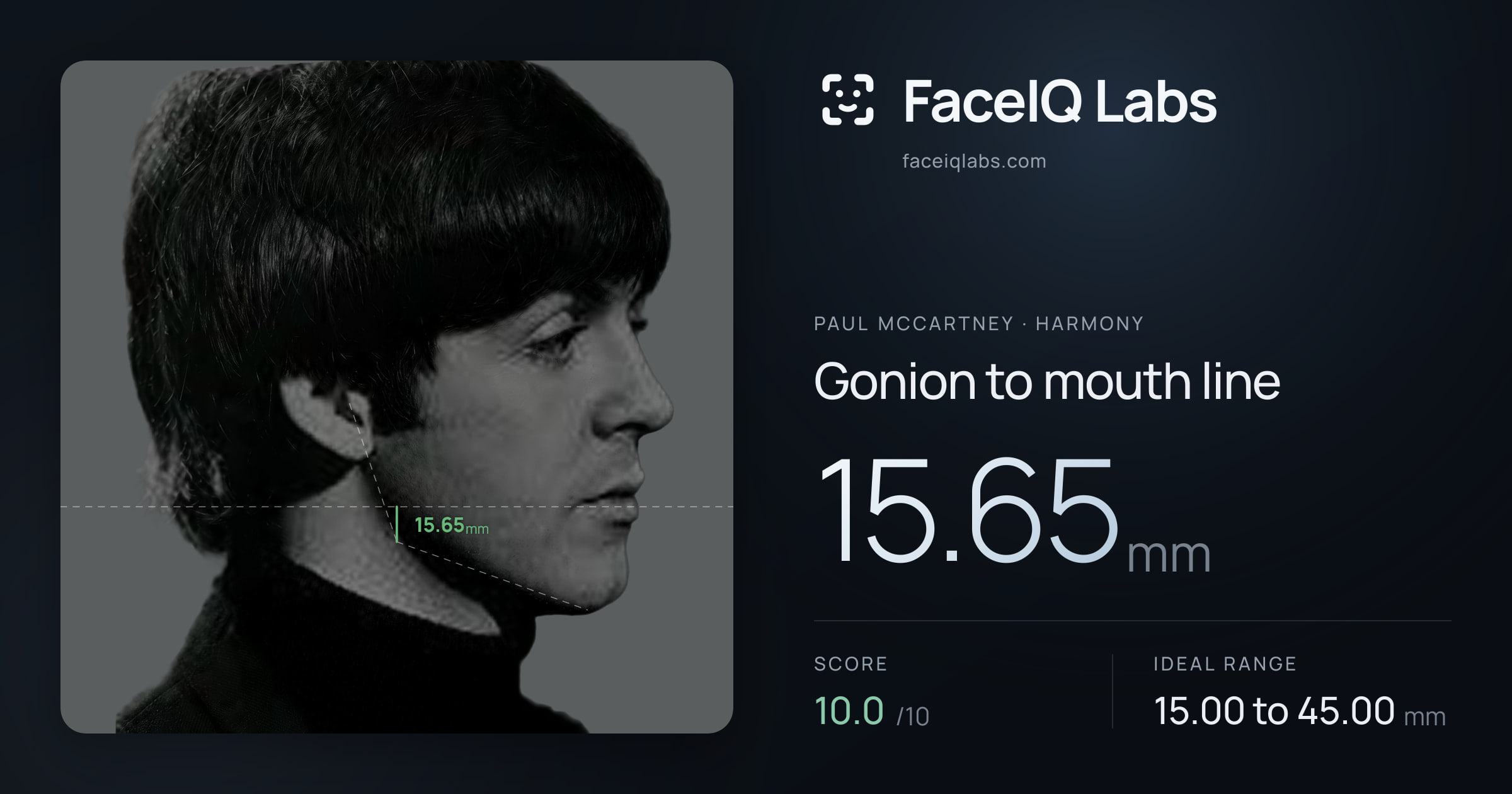Paul McCartney Gonion to mouth line: 15.65mm, drawn on the photo