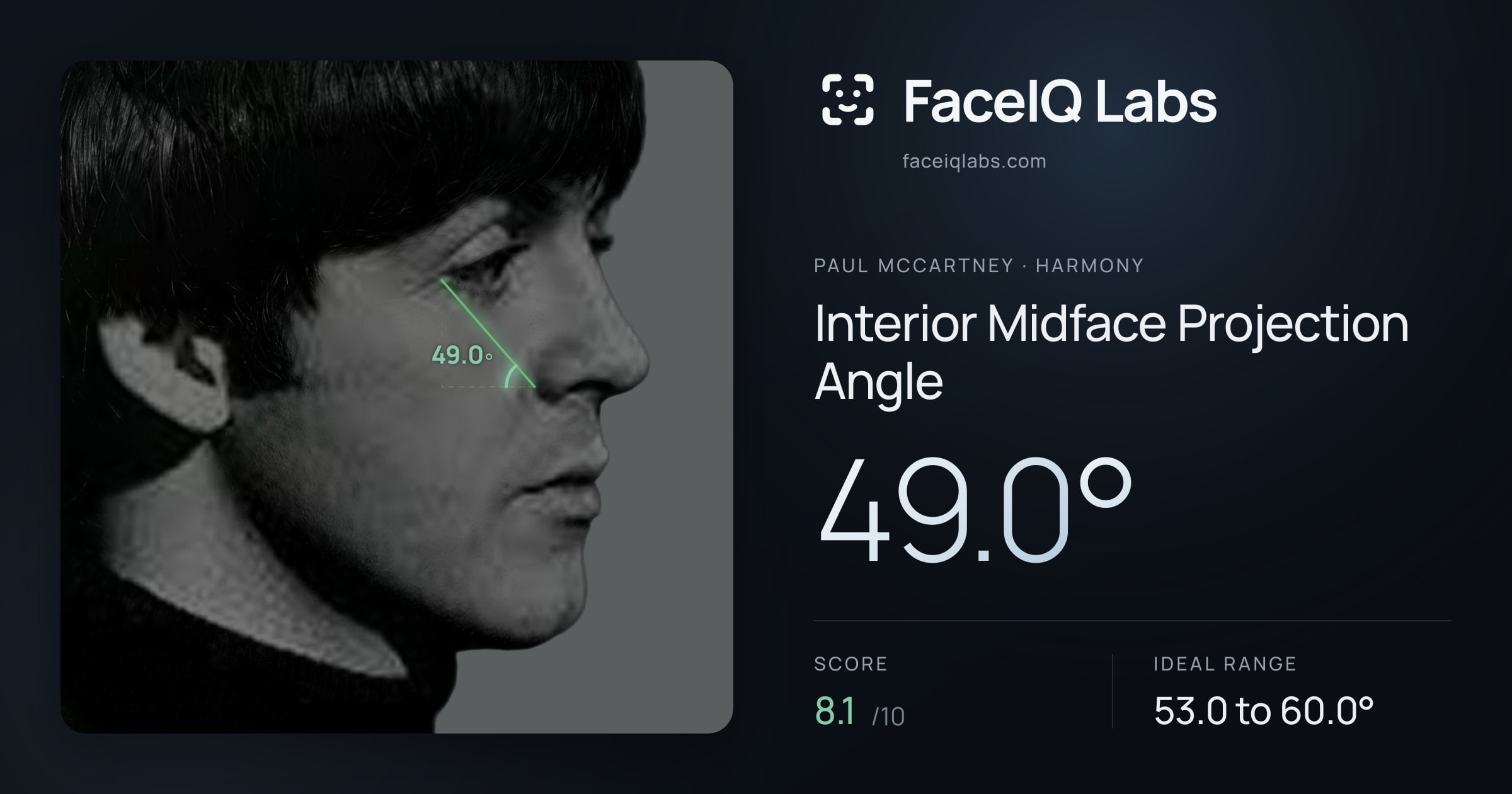 Paul McCartney Interior Midface Projection Angle: 49.0°, drawn on the photo