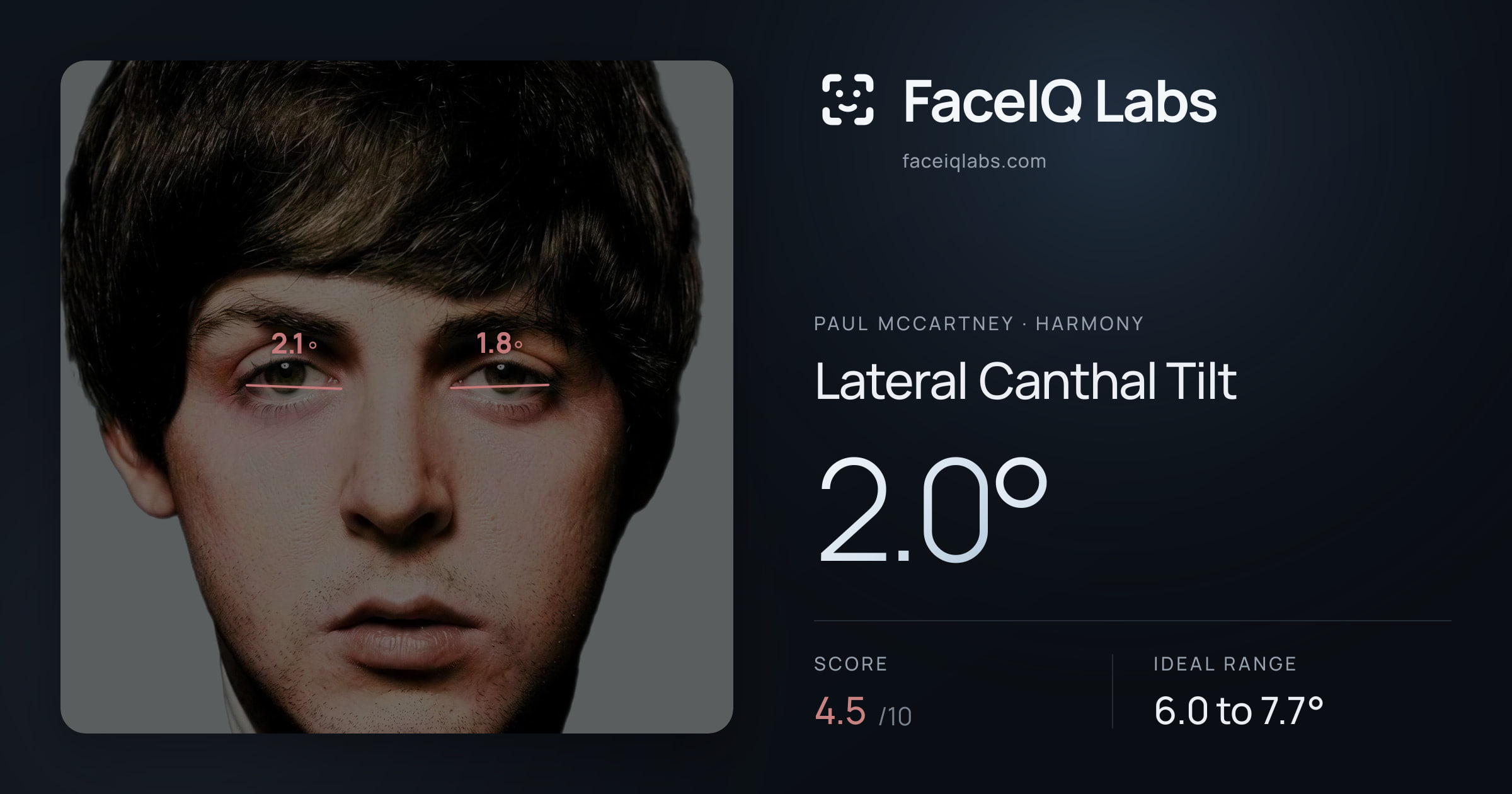 Paul McCartney Lateral Canthal Tilt: 2.0°, drawn on the photo