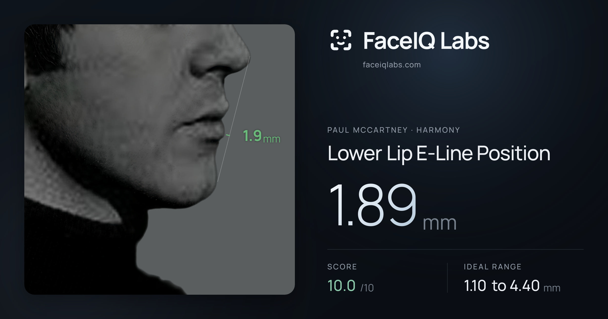 Paul McCartney Lower Lip E-Line Position: 1.89mm, drawn on the photo