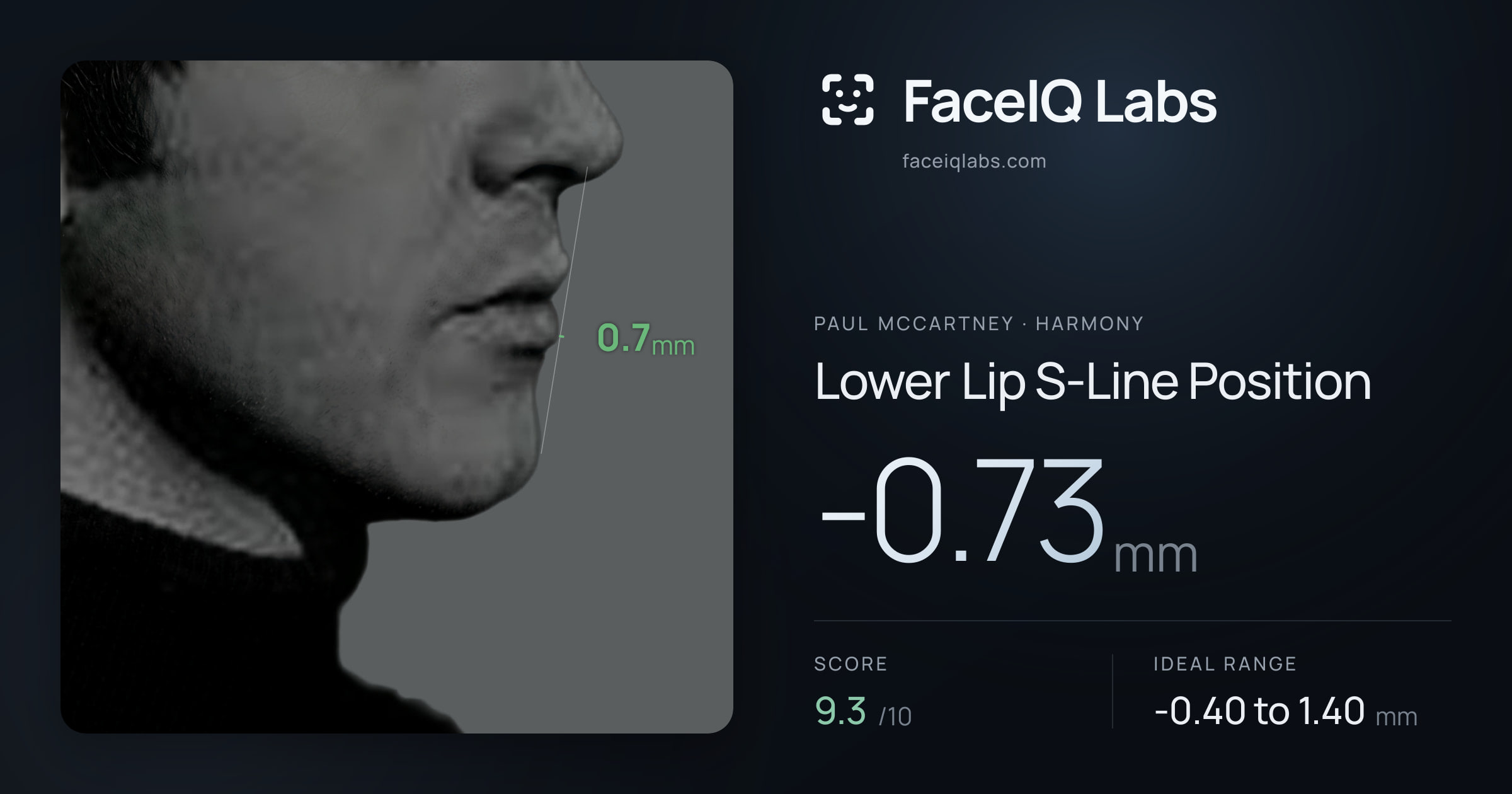 Paul McCartney Lower Lip S-Line Position: -0.73mm, drawn on the photo