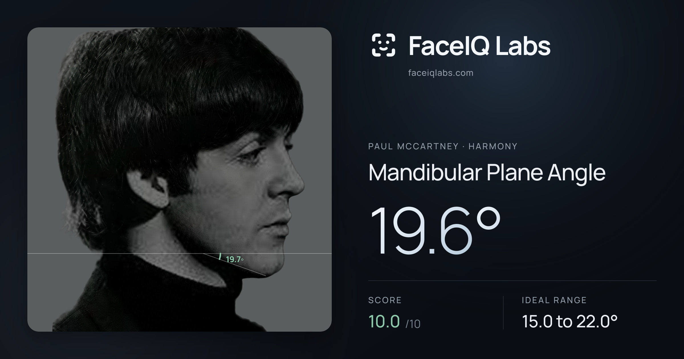 Paul McCartney Mandibular Plane Angle: 19.6°, drawn on the photo