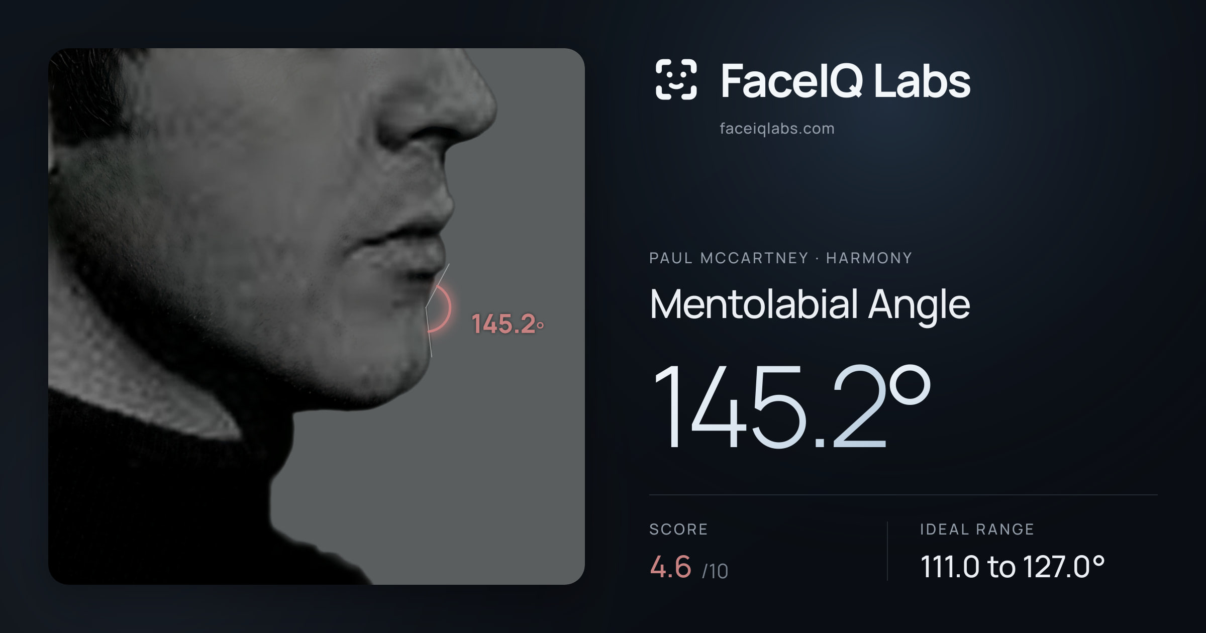 Paul McCartney Mentolabial Angle: 145.2°, drawn on the photo
