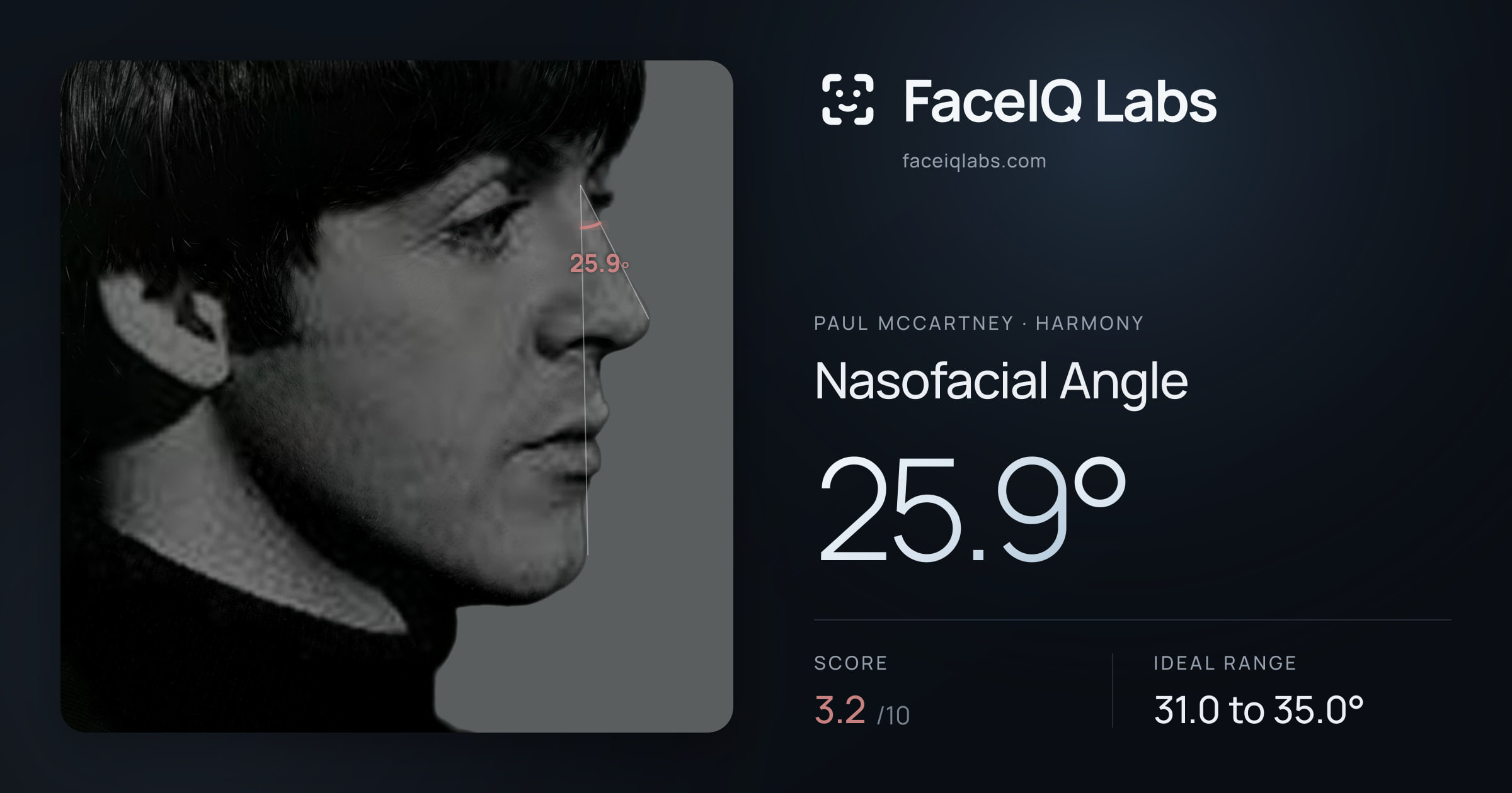 Paul McCartney Nasofacial Angle: 25.9°, drawn on the photo