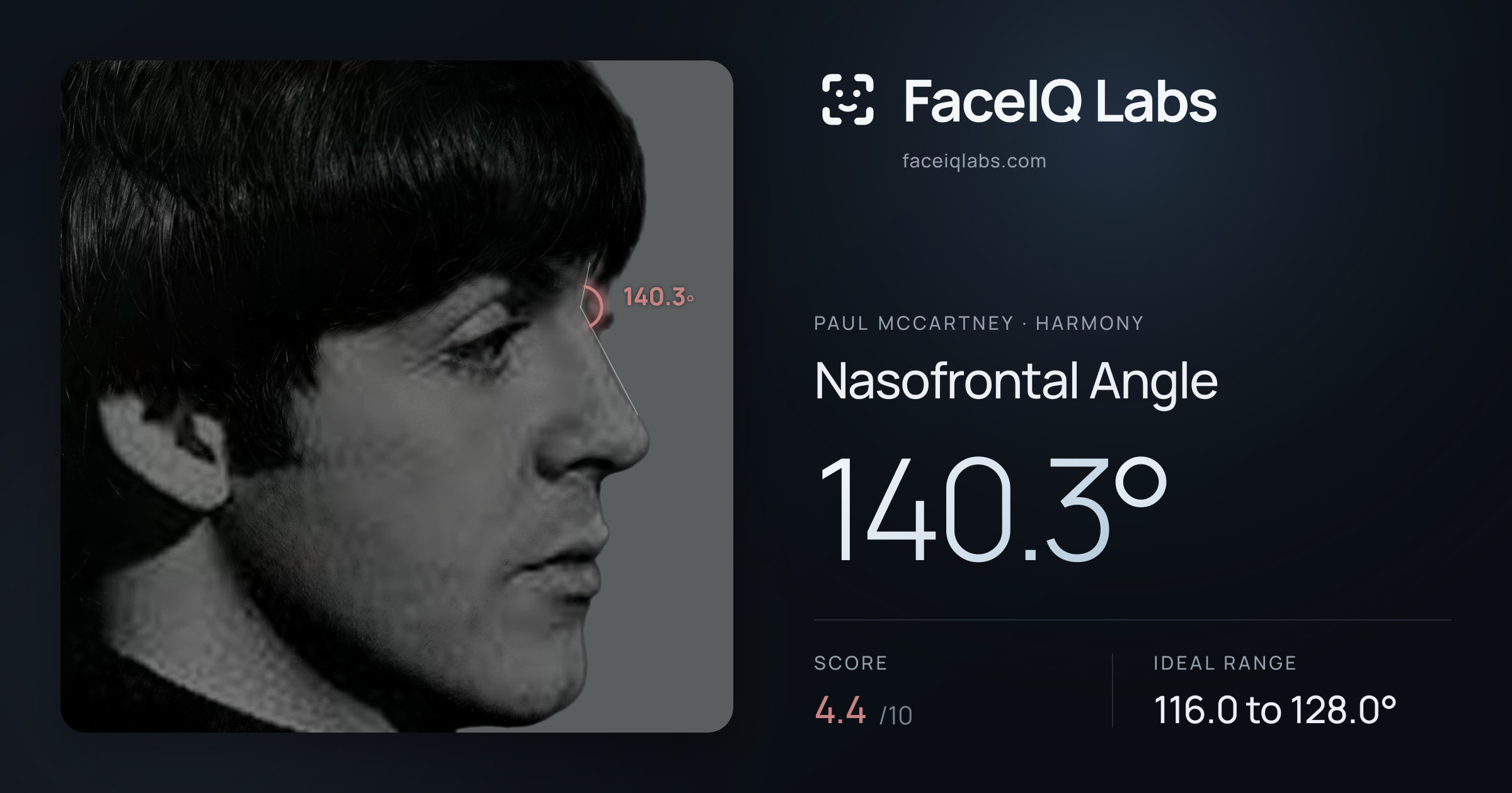 Paul McCartney Nasofrontal Angle: 140.3°, drawn on the photo