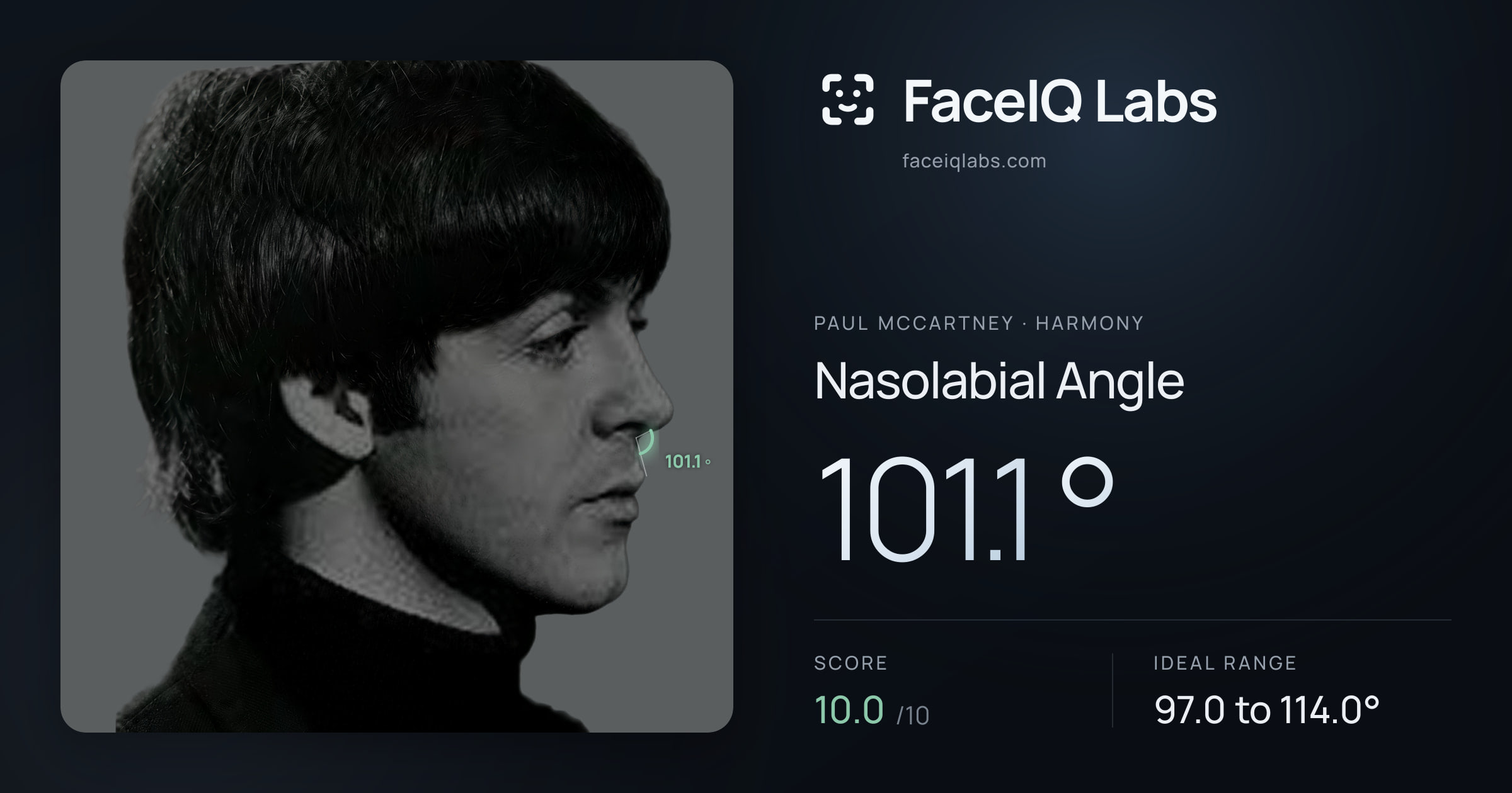 Paul McCartney Nasolabial Angle: 101.1°, drawn on the photo