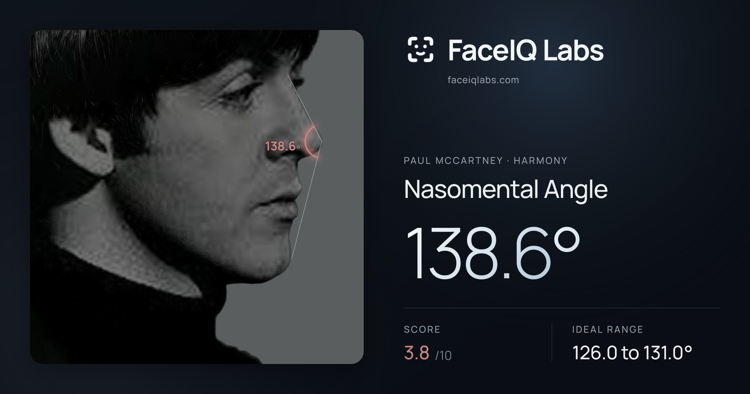 Paul McCartney Nasomental Angle: 138.6°, drawn on the photo