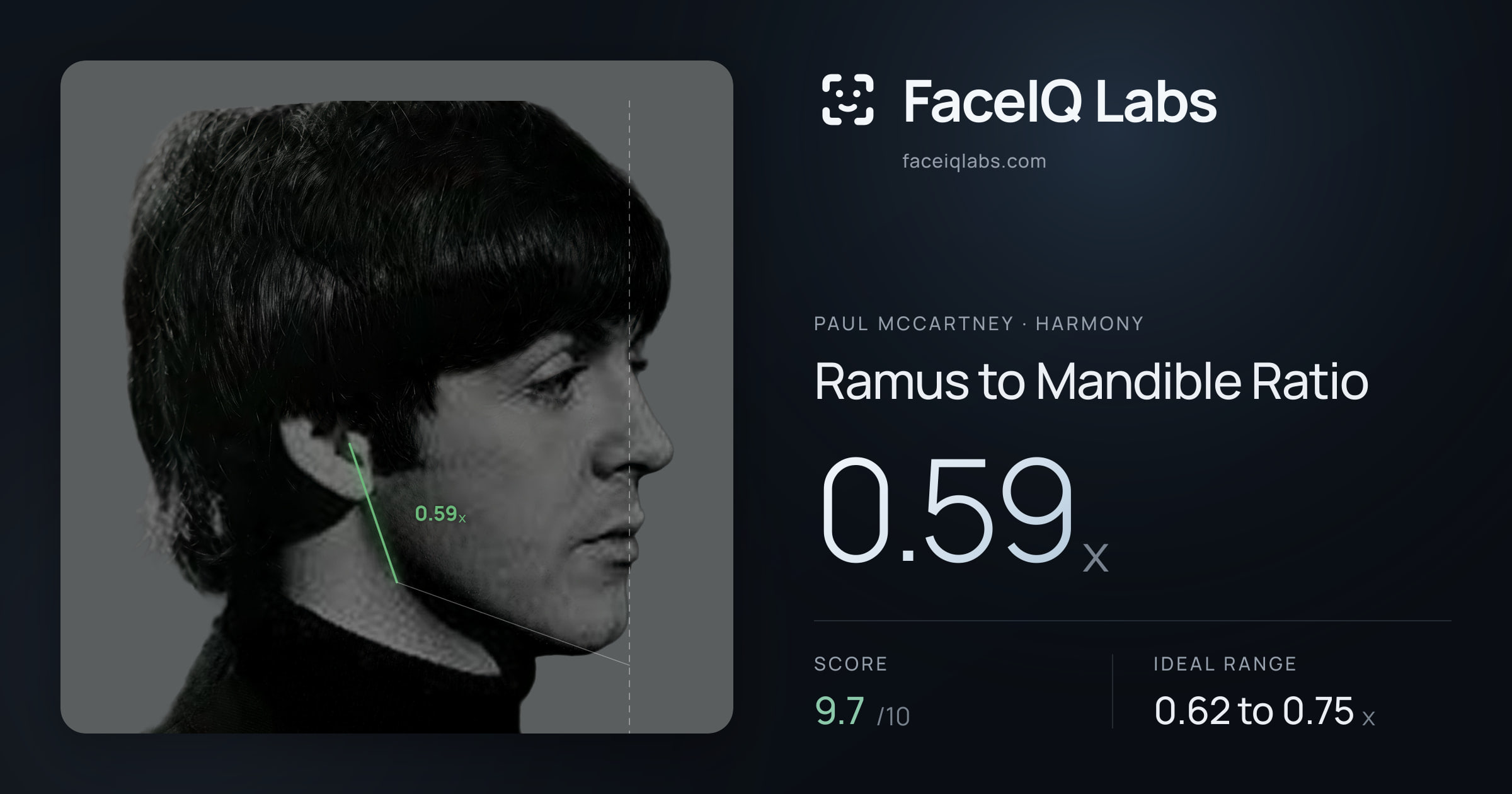 Paul McCartney Ramus to Mandible Ratio: 0.59x, drawn on the photo