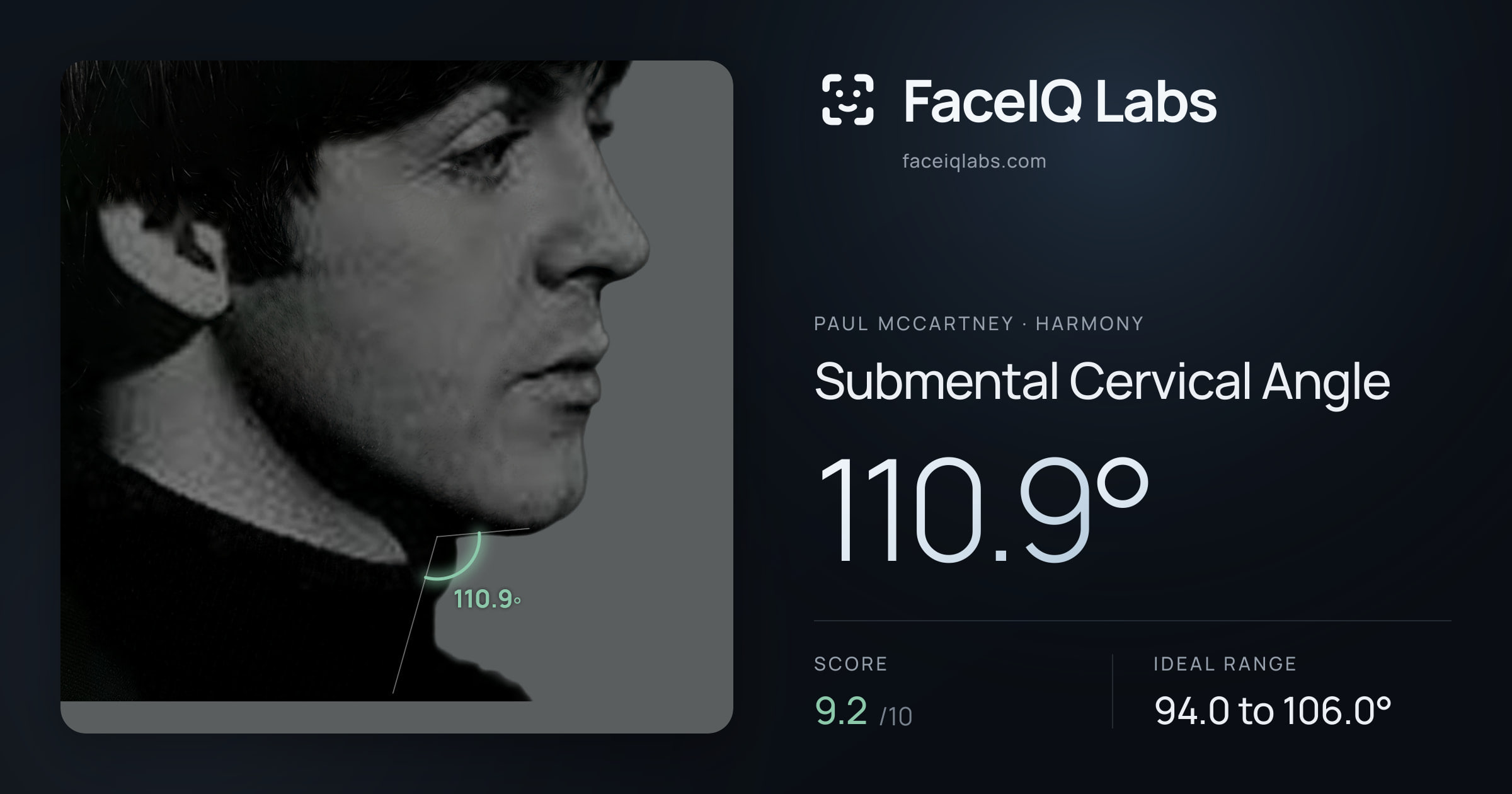 Paul McCartney Submental Cervical Angle: 110.9°, drawn on the photo
