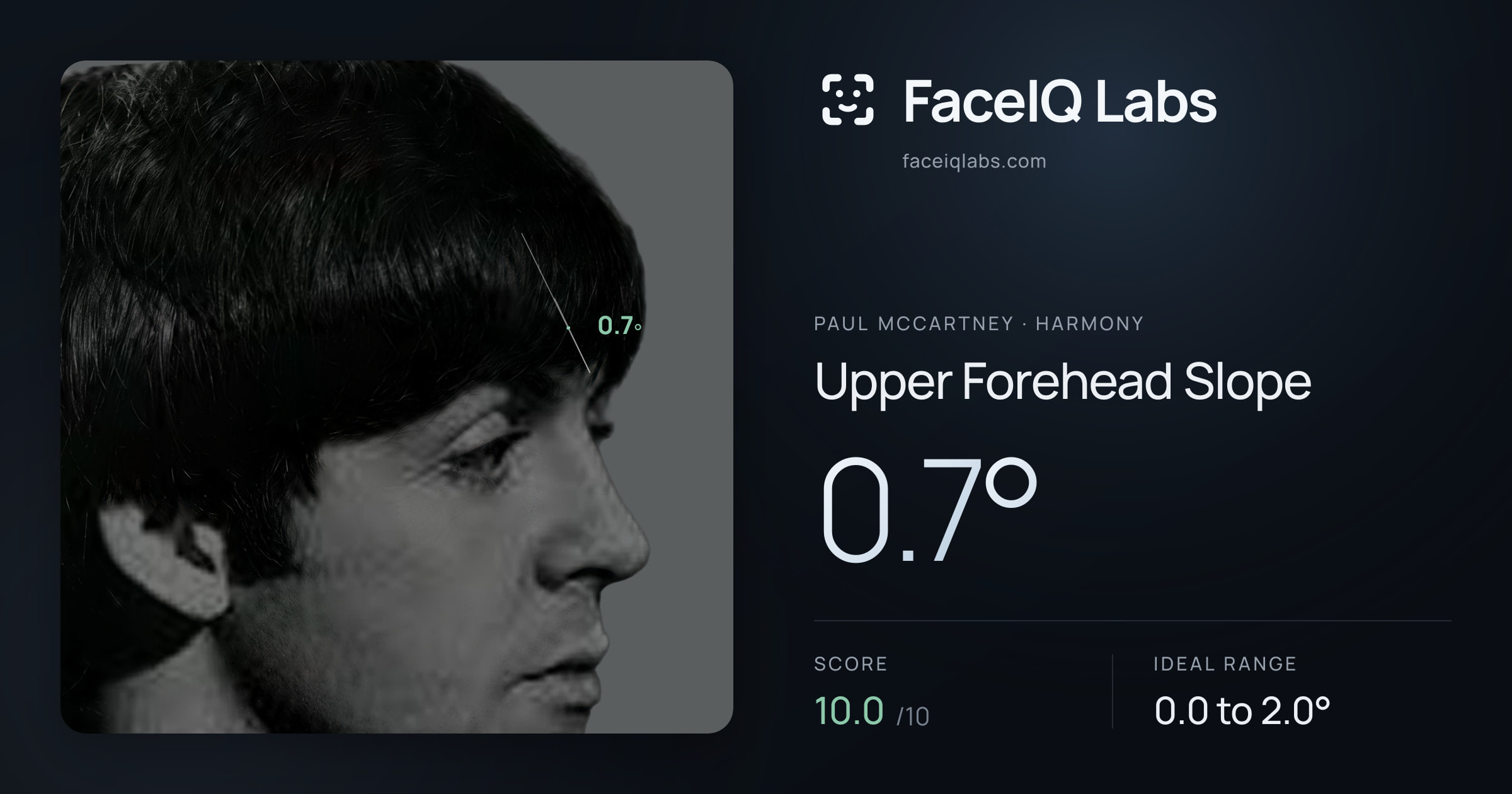 Paul McCartney Upper Forehead Slope: 0.7°, drawn on the photo