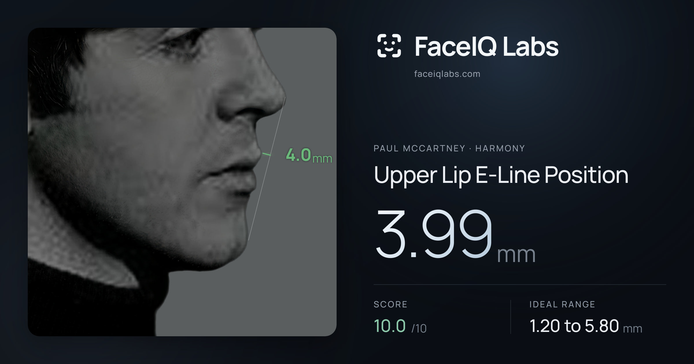 Paul McCartney Upper Lip E-Line Position: 3.99mm, drawn on the photo